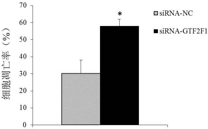 Diagnosis and treatment product for multiple myeloma biomarker