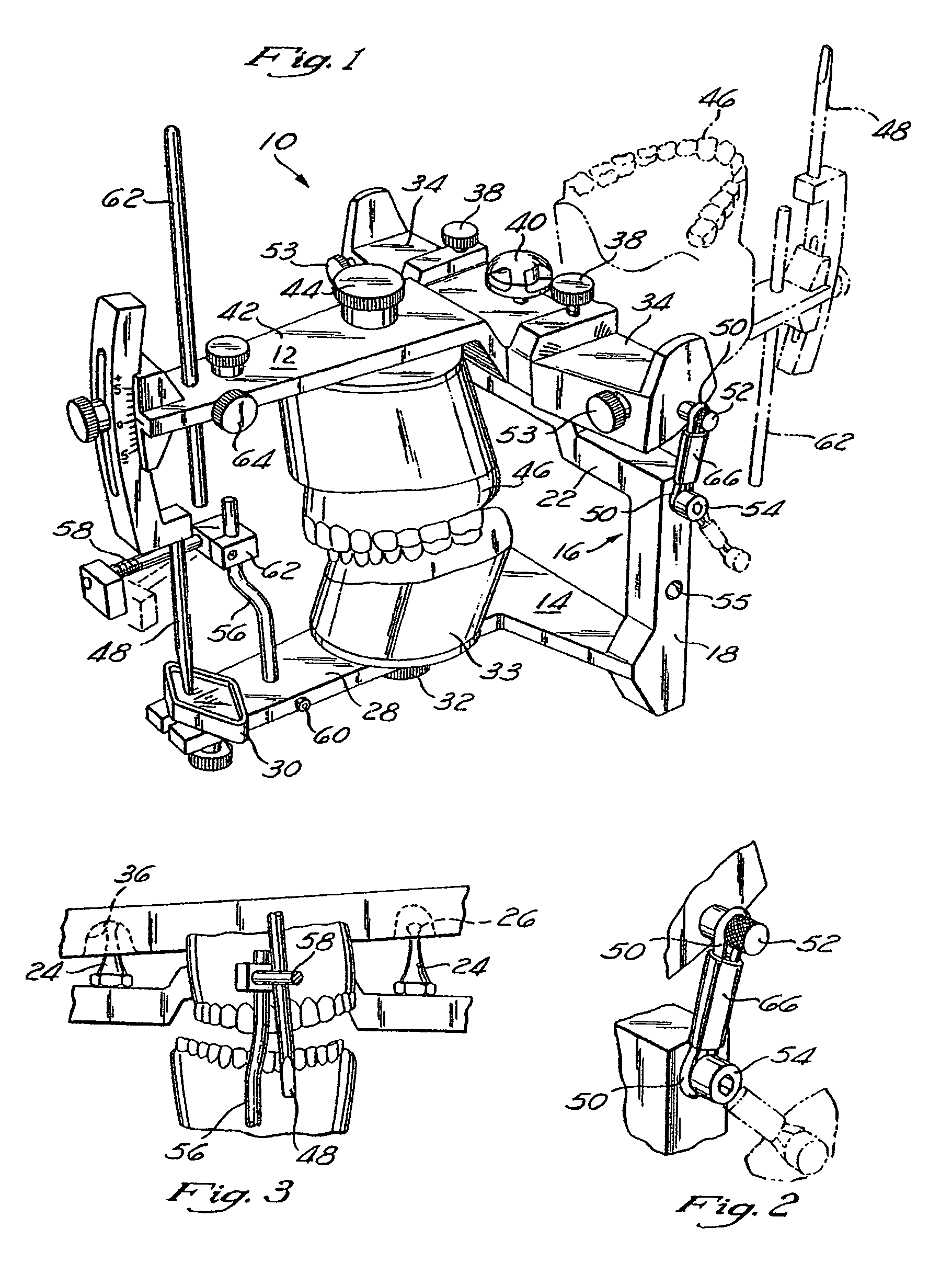 Dental articulator