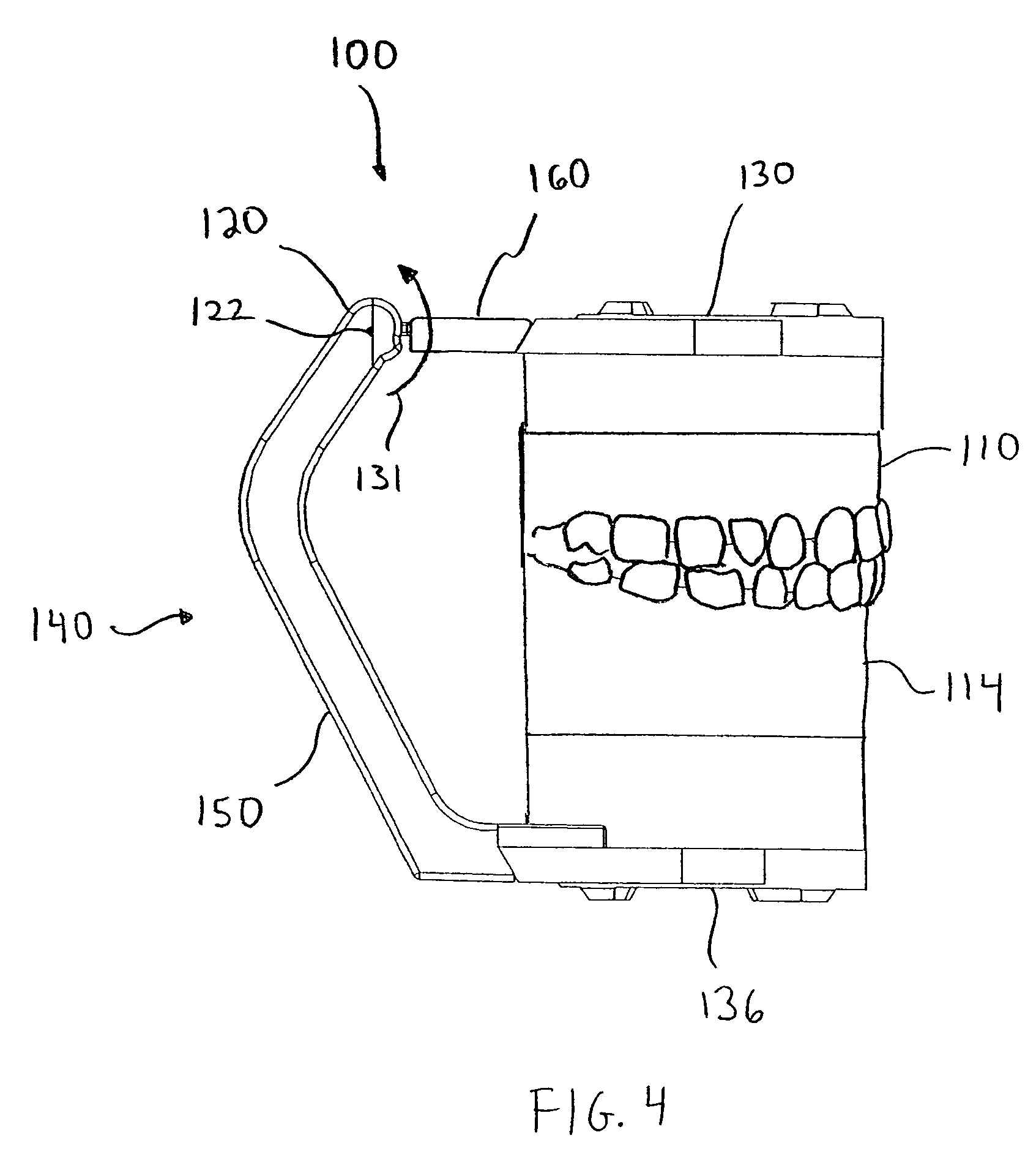 Dental articulator