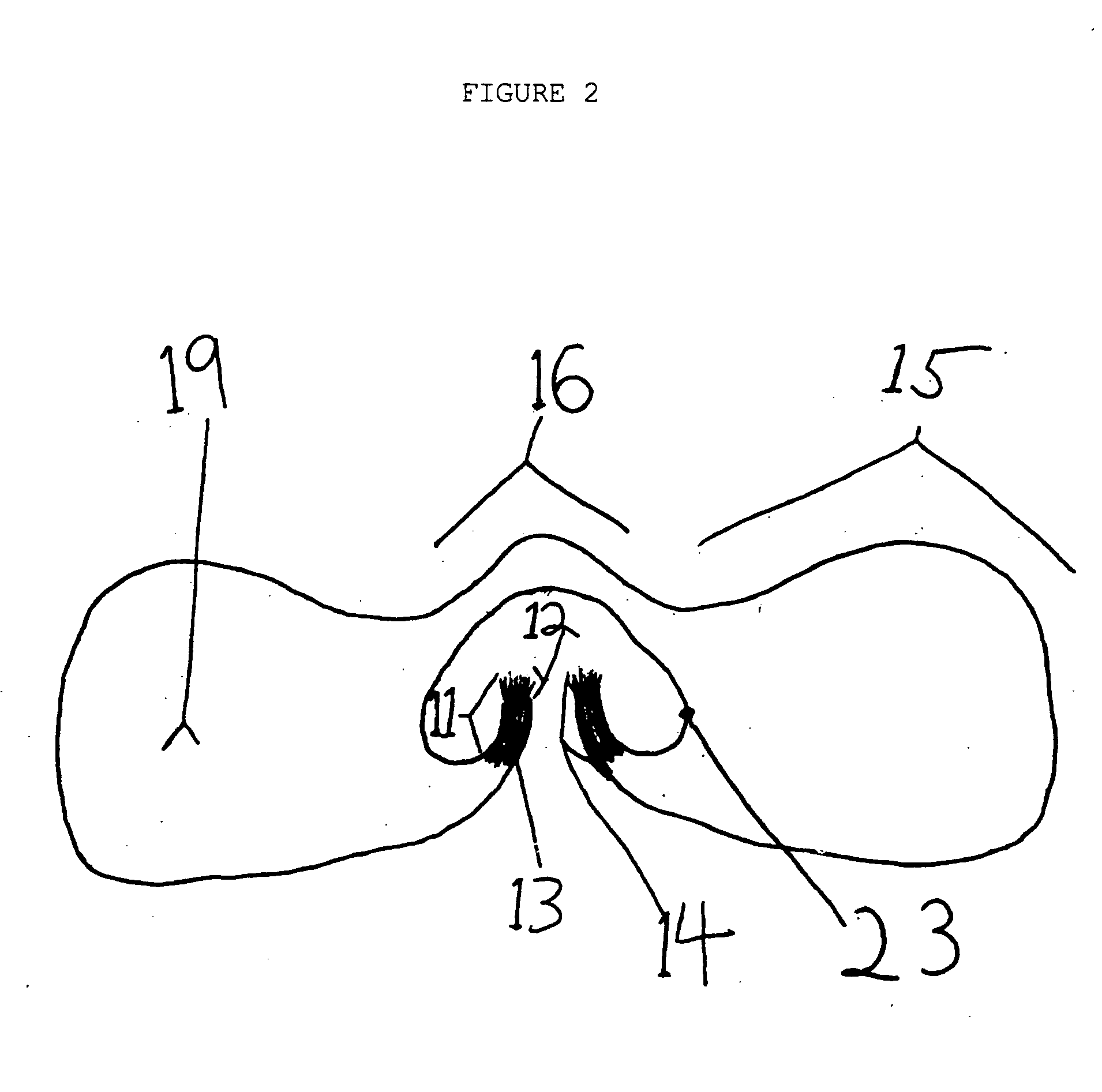 Continuous nasal irrigation device