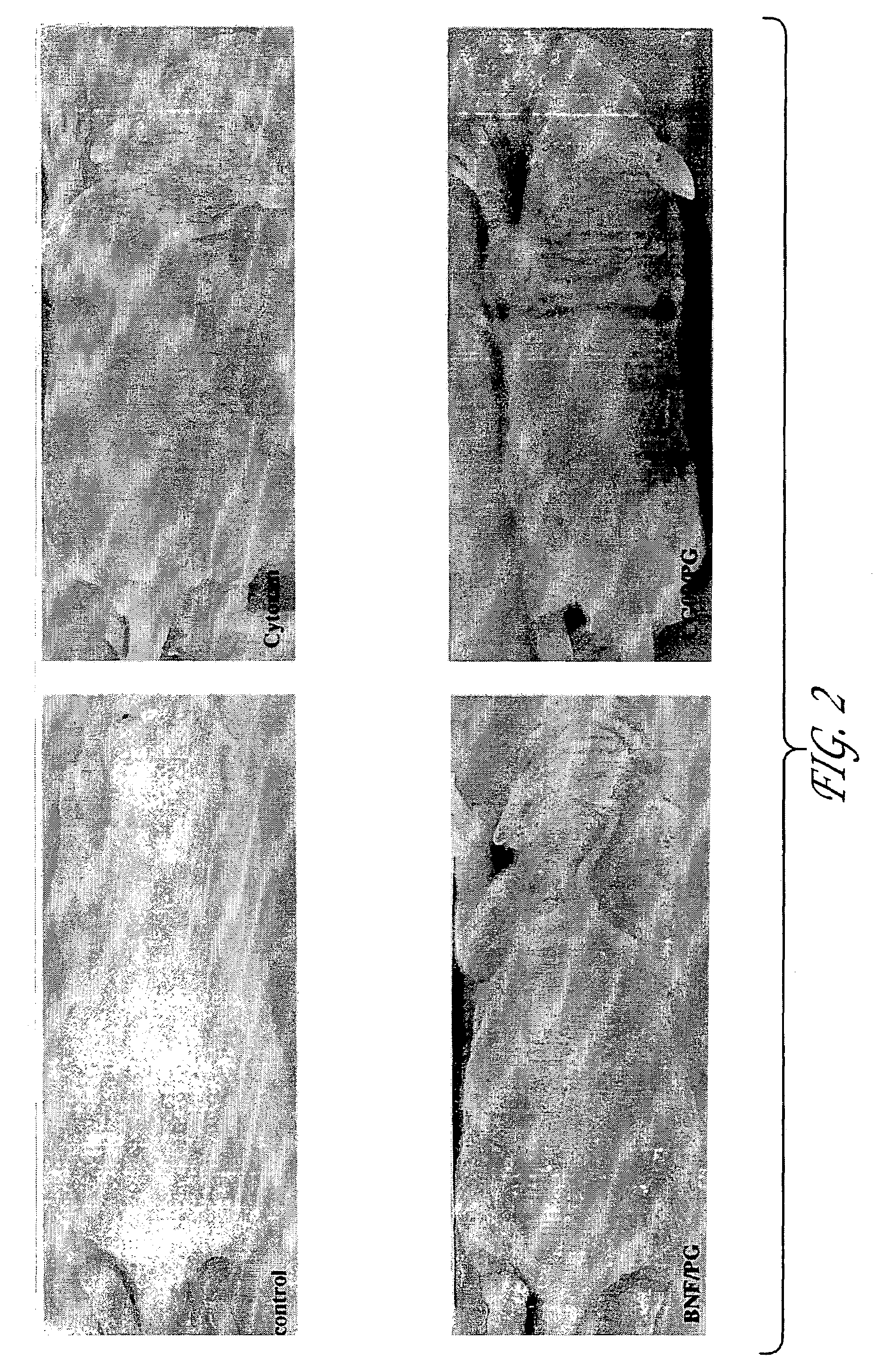 Compositions and methods for protecting cells during cancer chemotherapy and radiotherapy