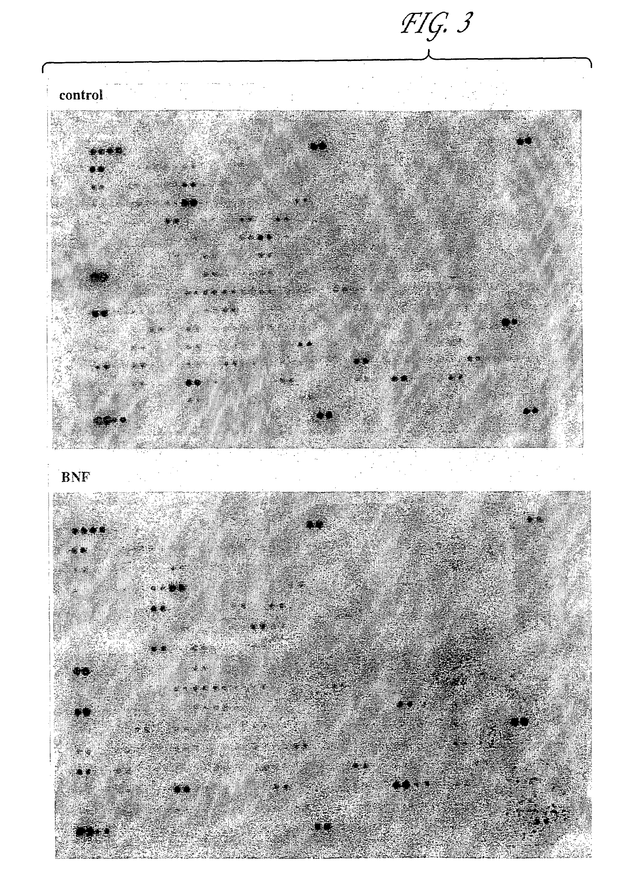 Compositions and methods for protecting cells during cancer chemotherapy and radiotherapy