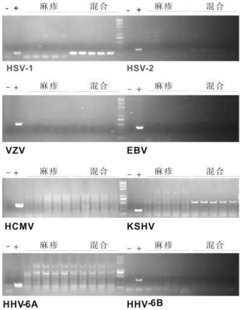 Rapid detection and quantification reagents and kits for various subtypes of human herpesvirus