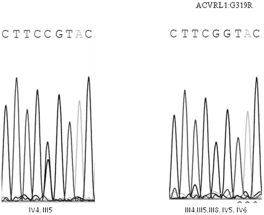 Pulmonary hypertension virulence gene ACVRL1 mutation site and application thereof