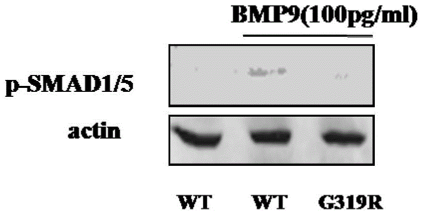 Pulmonary hypertension virulence gene ACVRL1 mutation site and application thereof