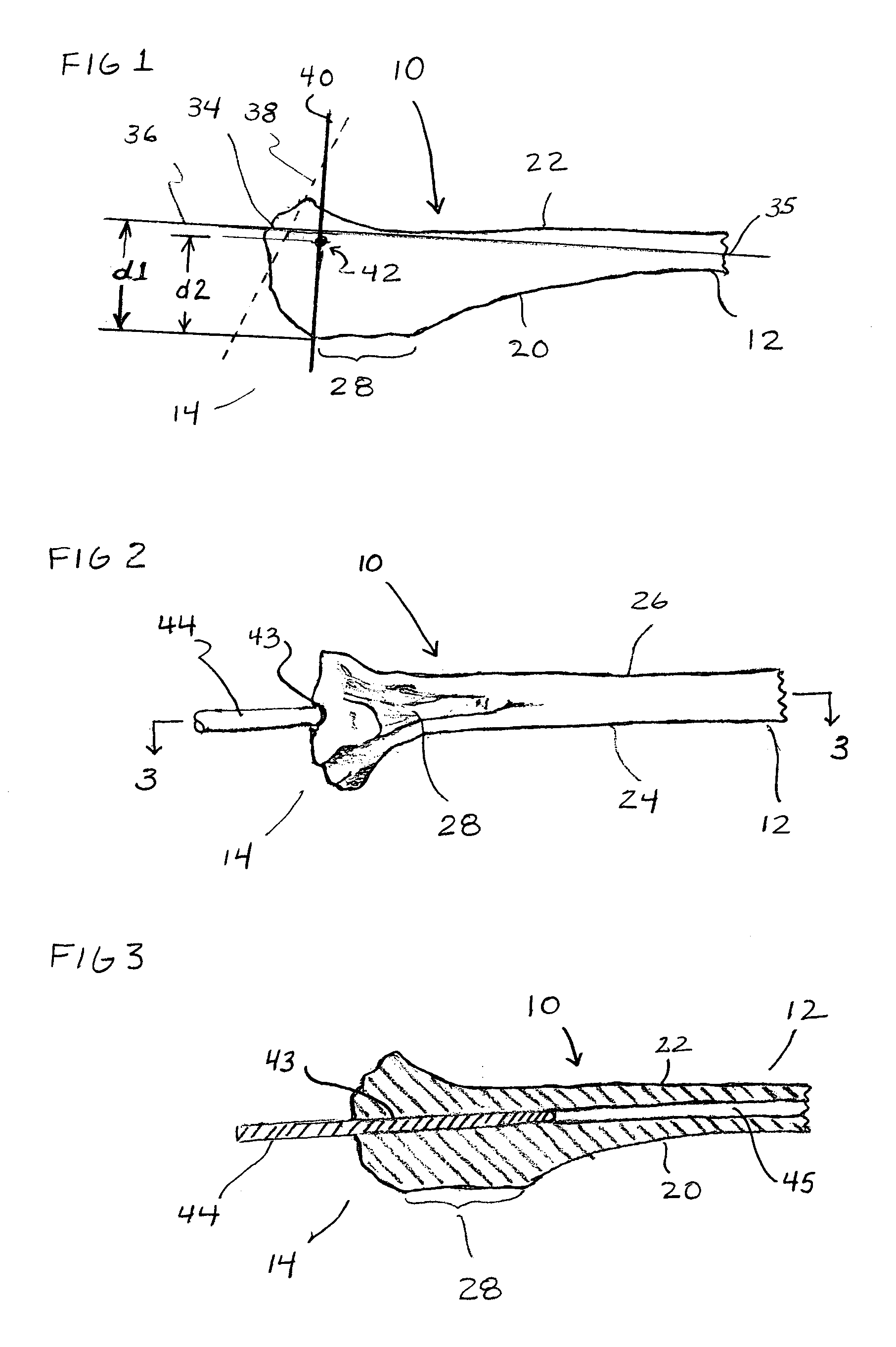 Apparatus and method for anterior cruciate repair