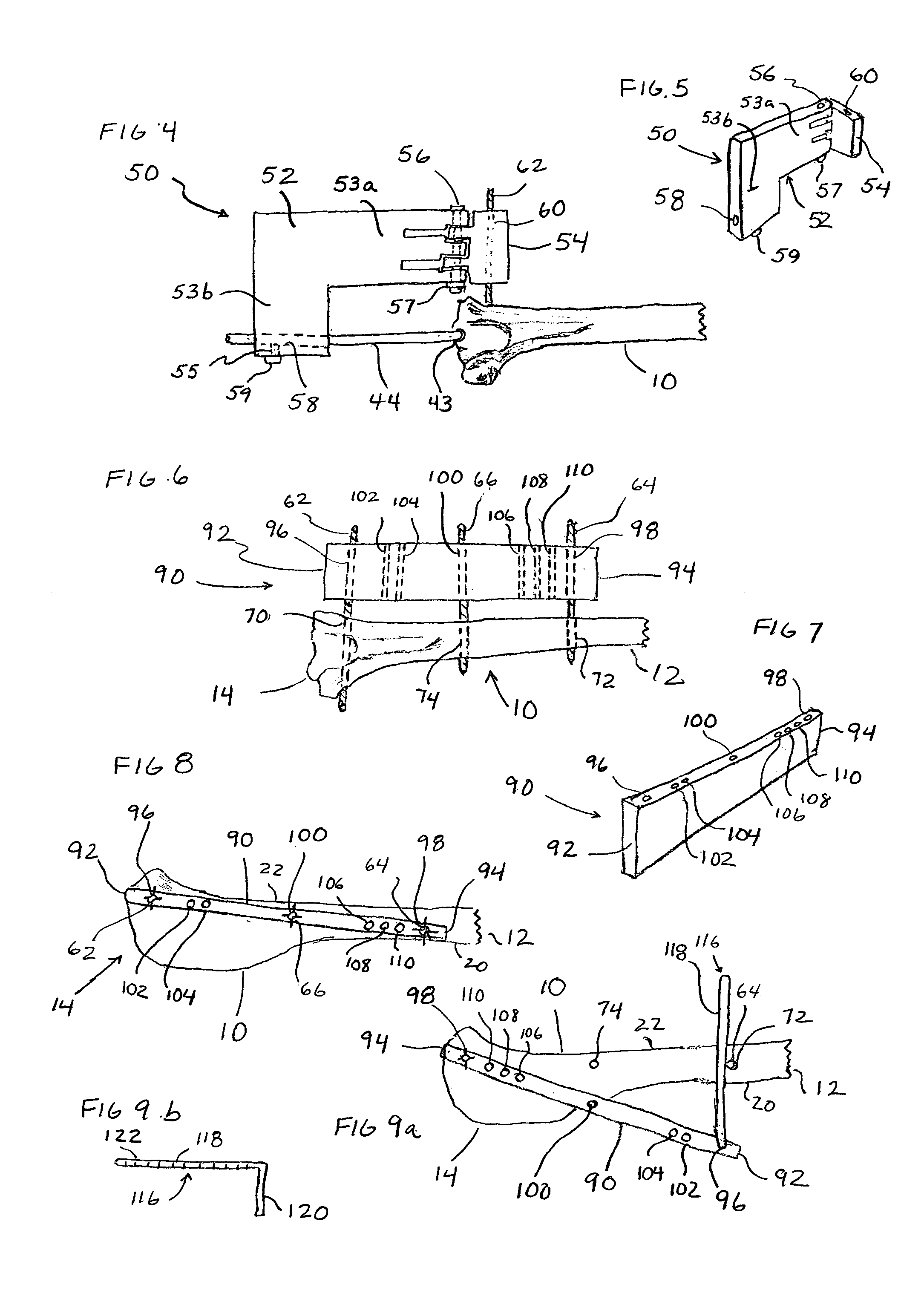 Apparatus and method for anterior cruciate repair