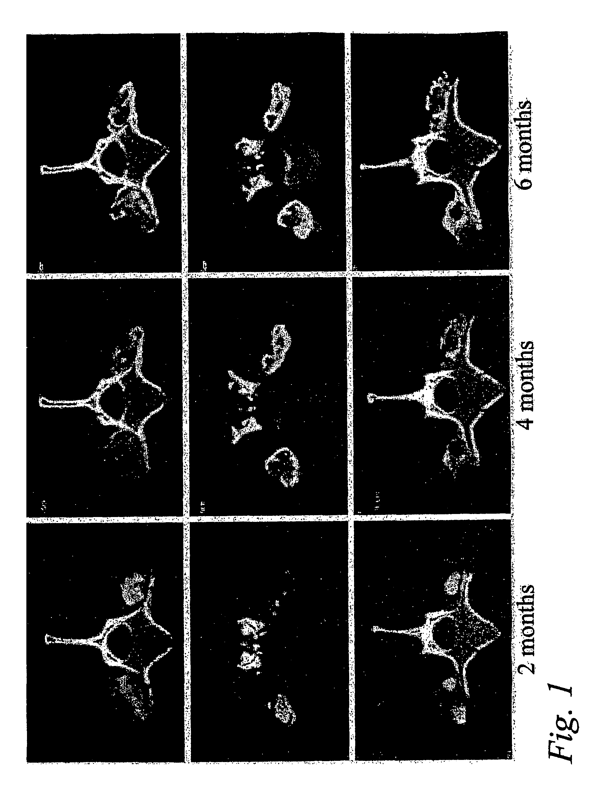 Spinal fusion methods and devices