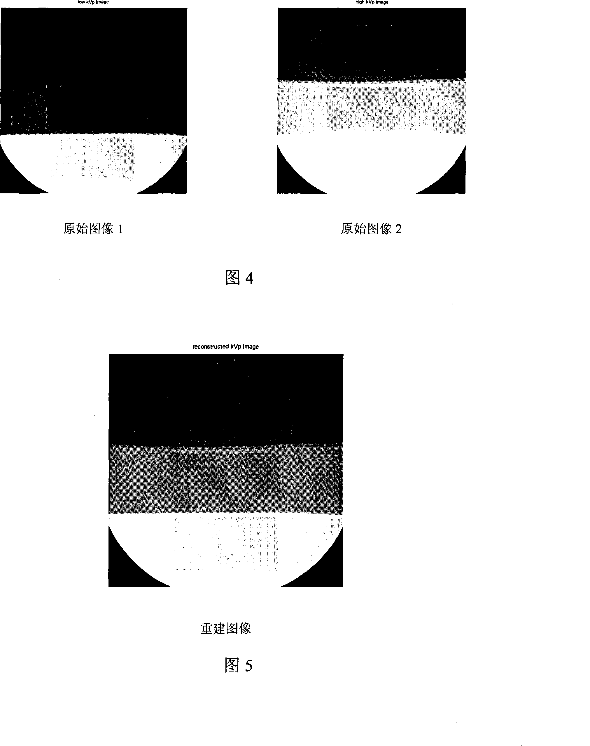 High dynamic range regenerating method of X-ray image based on scale space decomposition