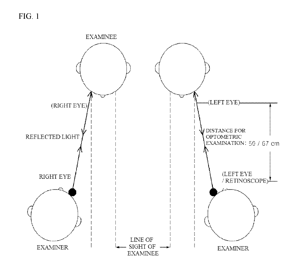 Apparatus for retinoscopy