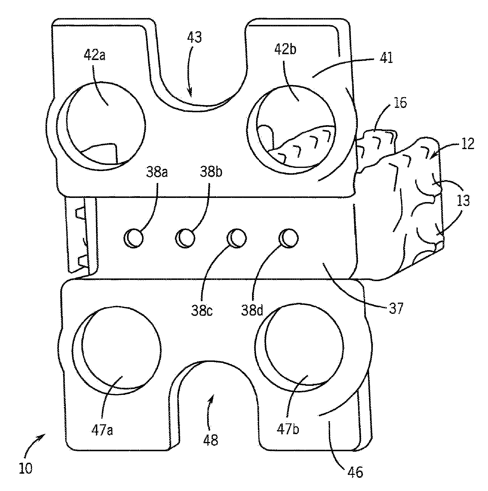 Degradable cage for bone fusion