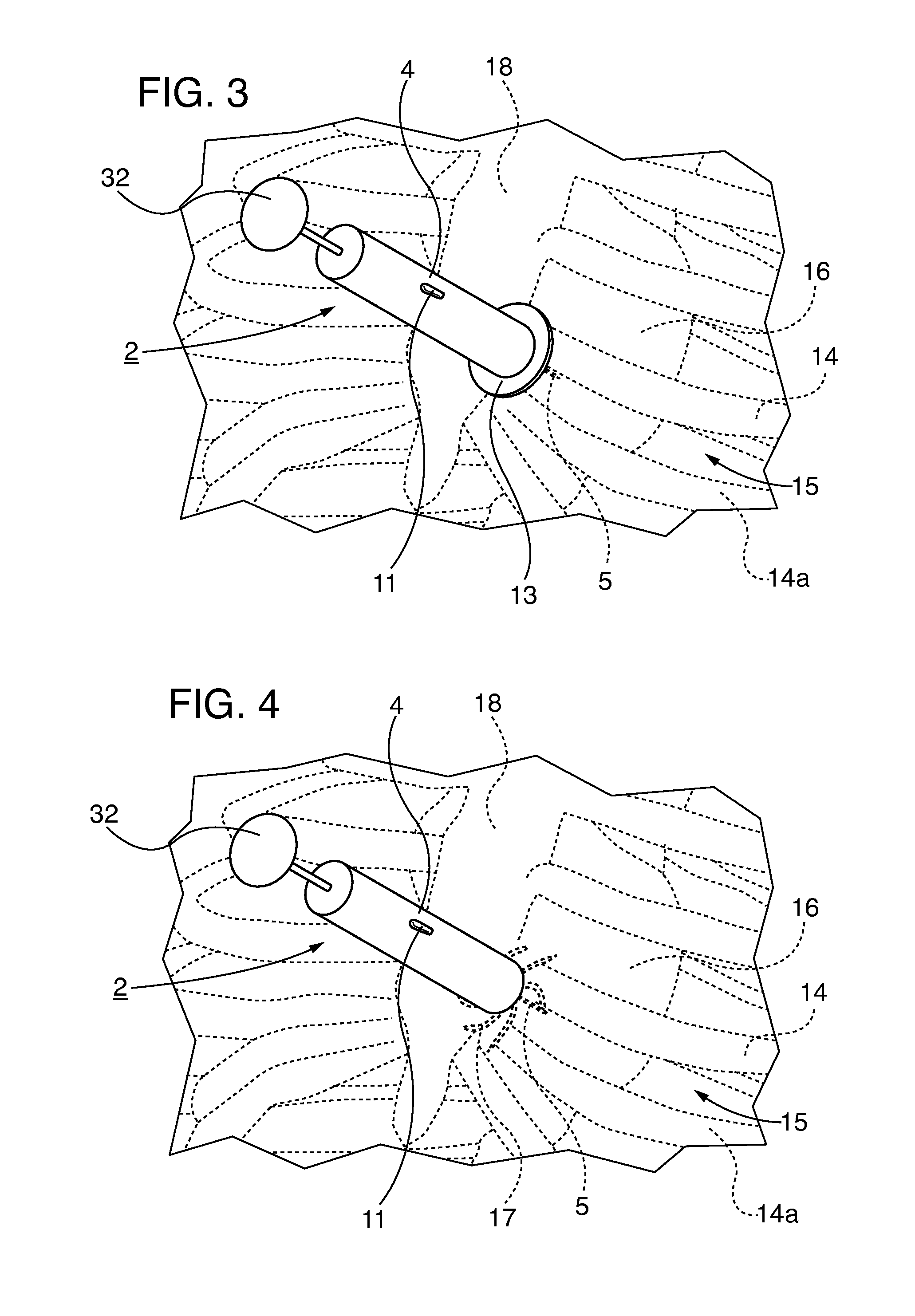 Piezo-electric defibrillation system