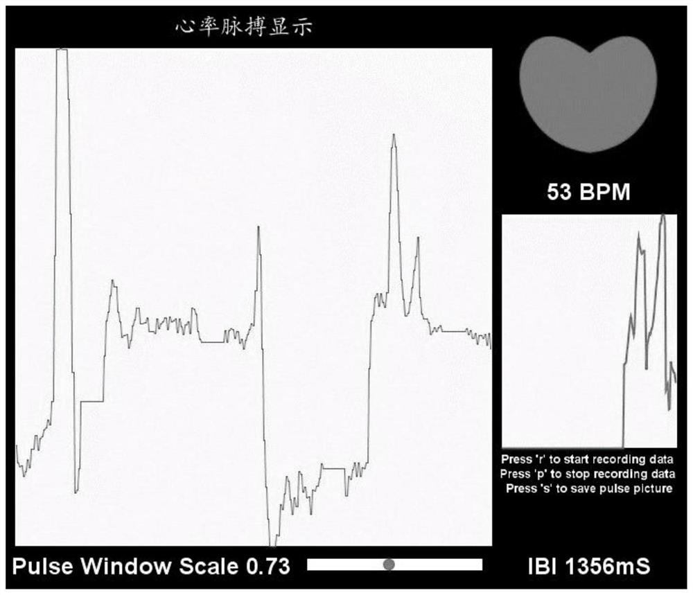 Cardiovascular and cerebrovascular disease recognition system based on echo state network