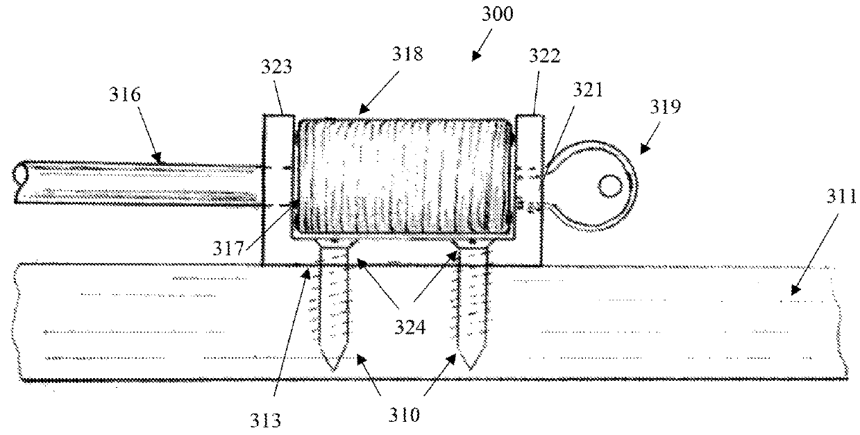 Cable locking device