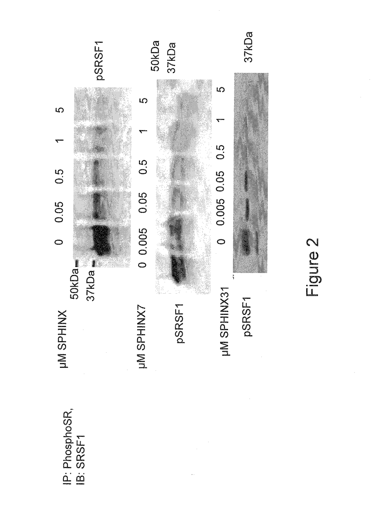 Piperazine derivatives for treating disorders