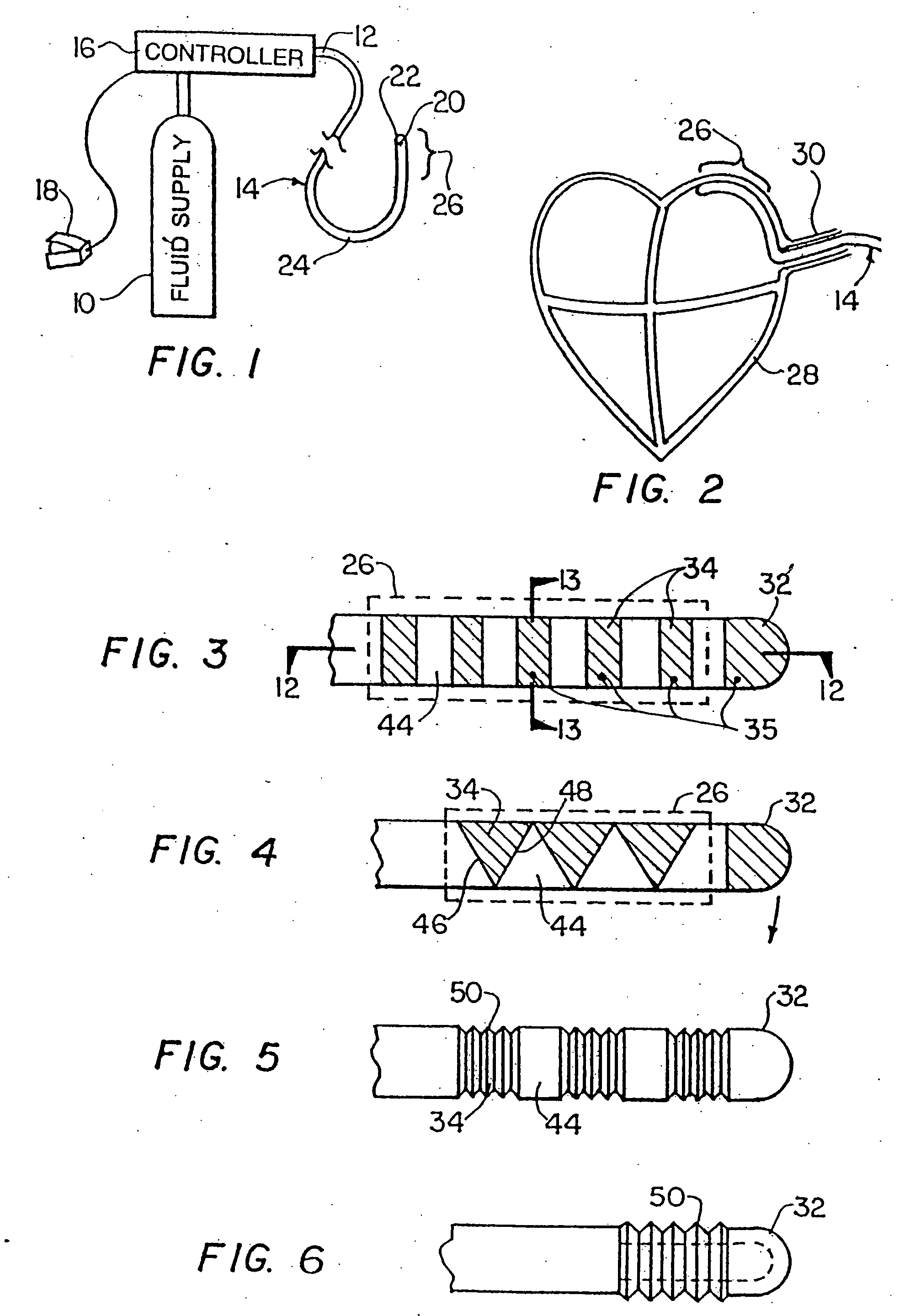 Method and device for epicardial ablation