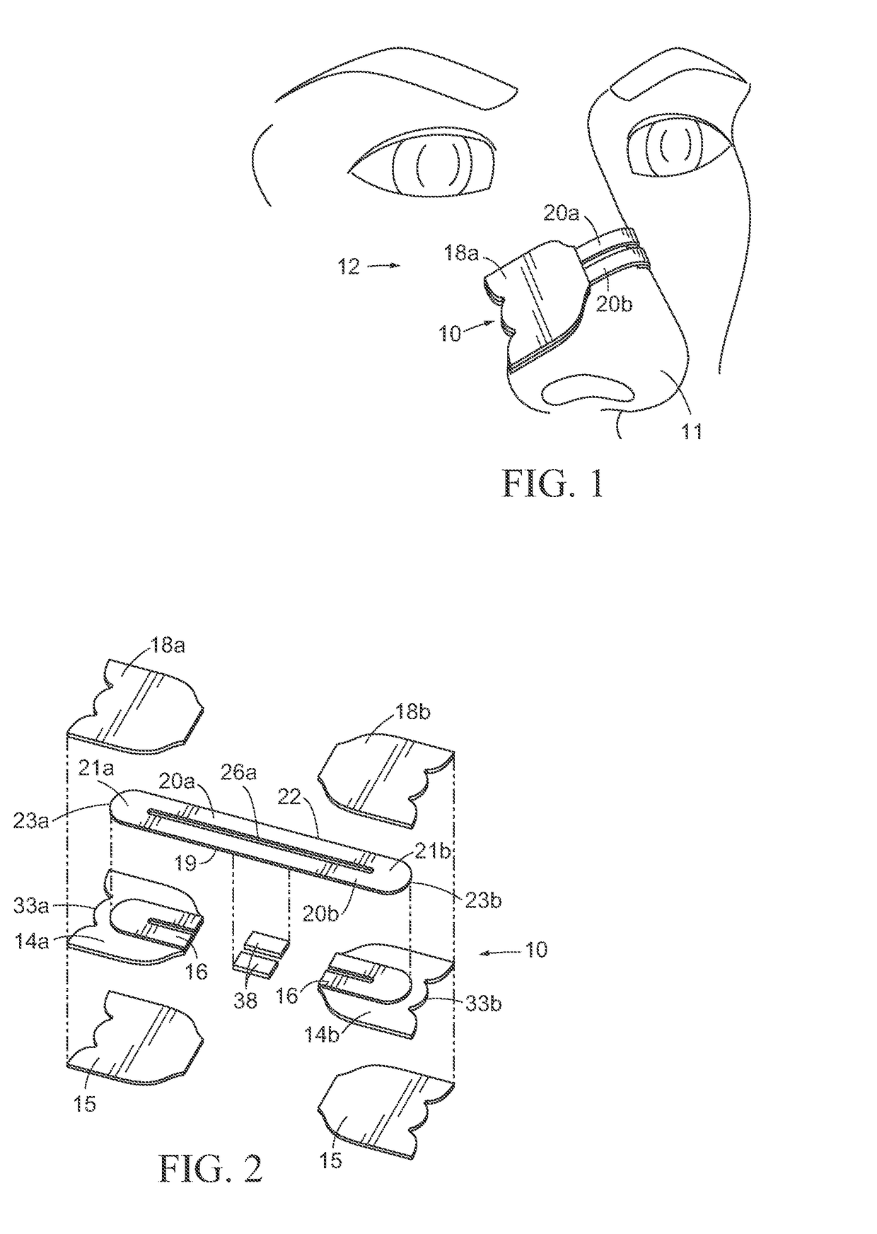 Economical Nasal Dilator and Method of Manufacture