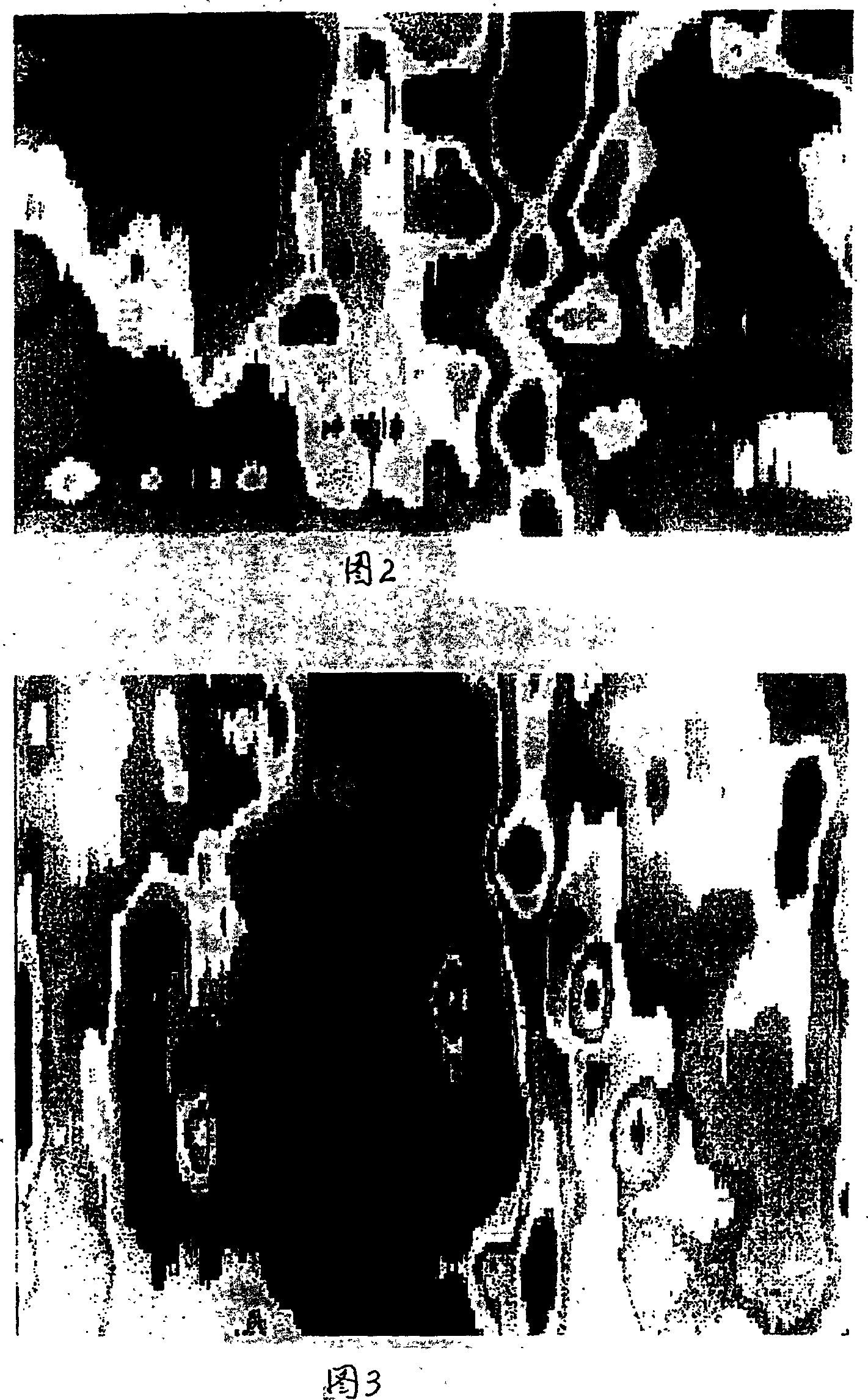 Metal in-situ statistical-distribution analysis method