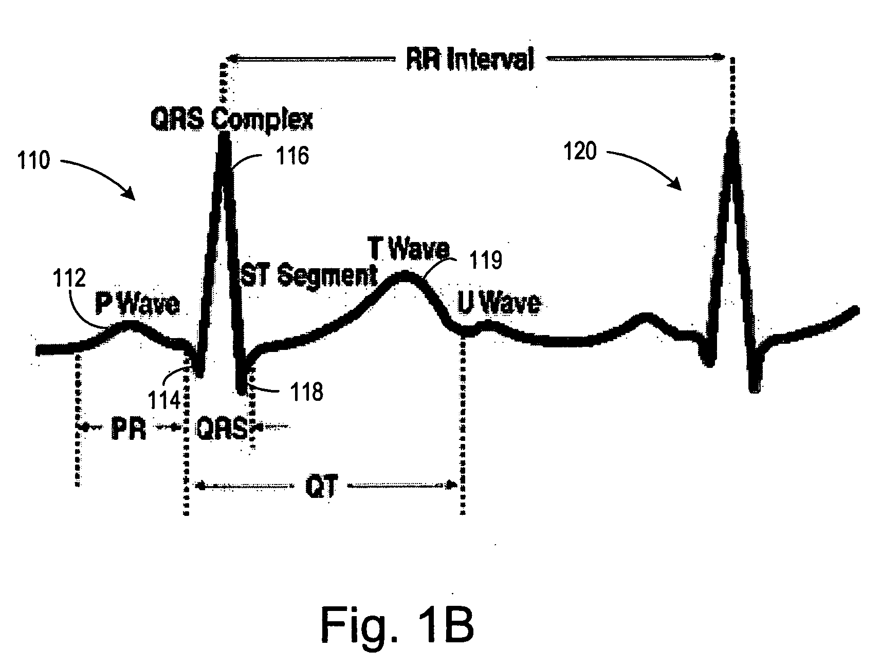 Closed loop cardiac resynchronization therapy using cardiac activation sequence information