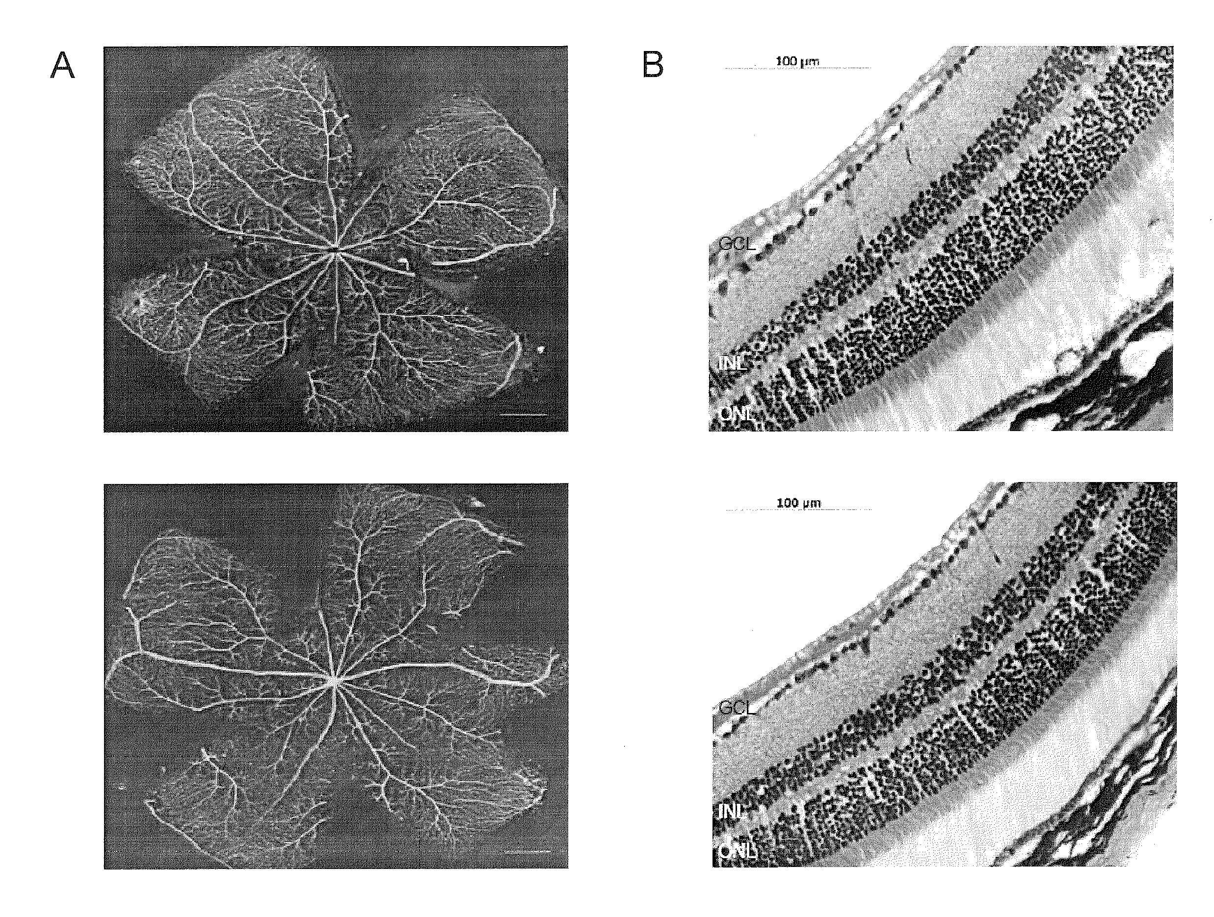 Mdm2 inhibitors for treatment of ocular conditions