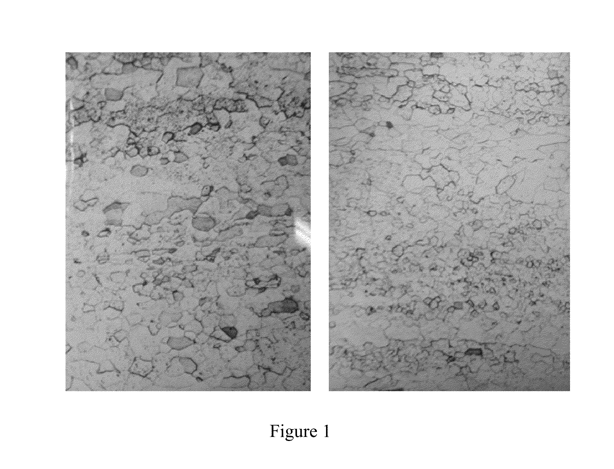 Method for preparing high-performance tantalum target