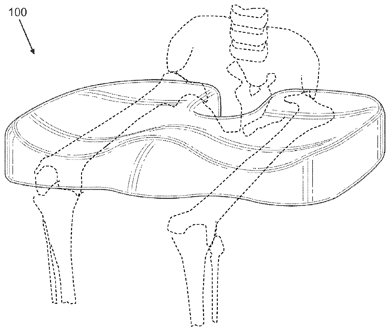 Reversible orthopedic seat cushion