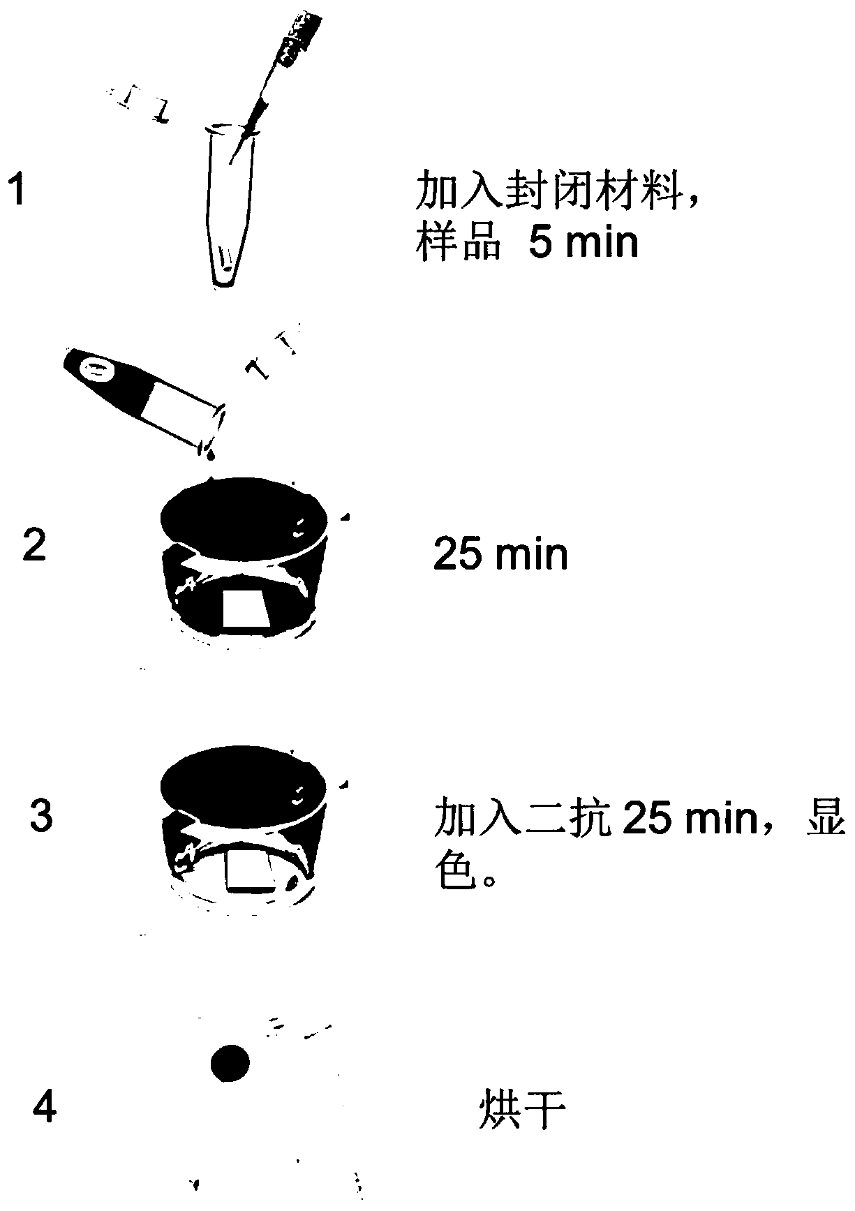 Detection material for resisting CASPR2 autoantibodies in human body fluid, preparation method and application