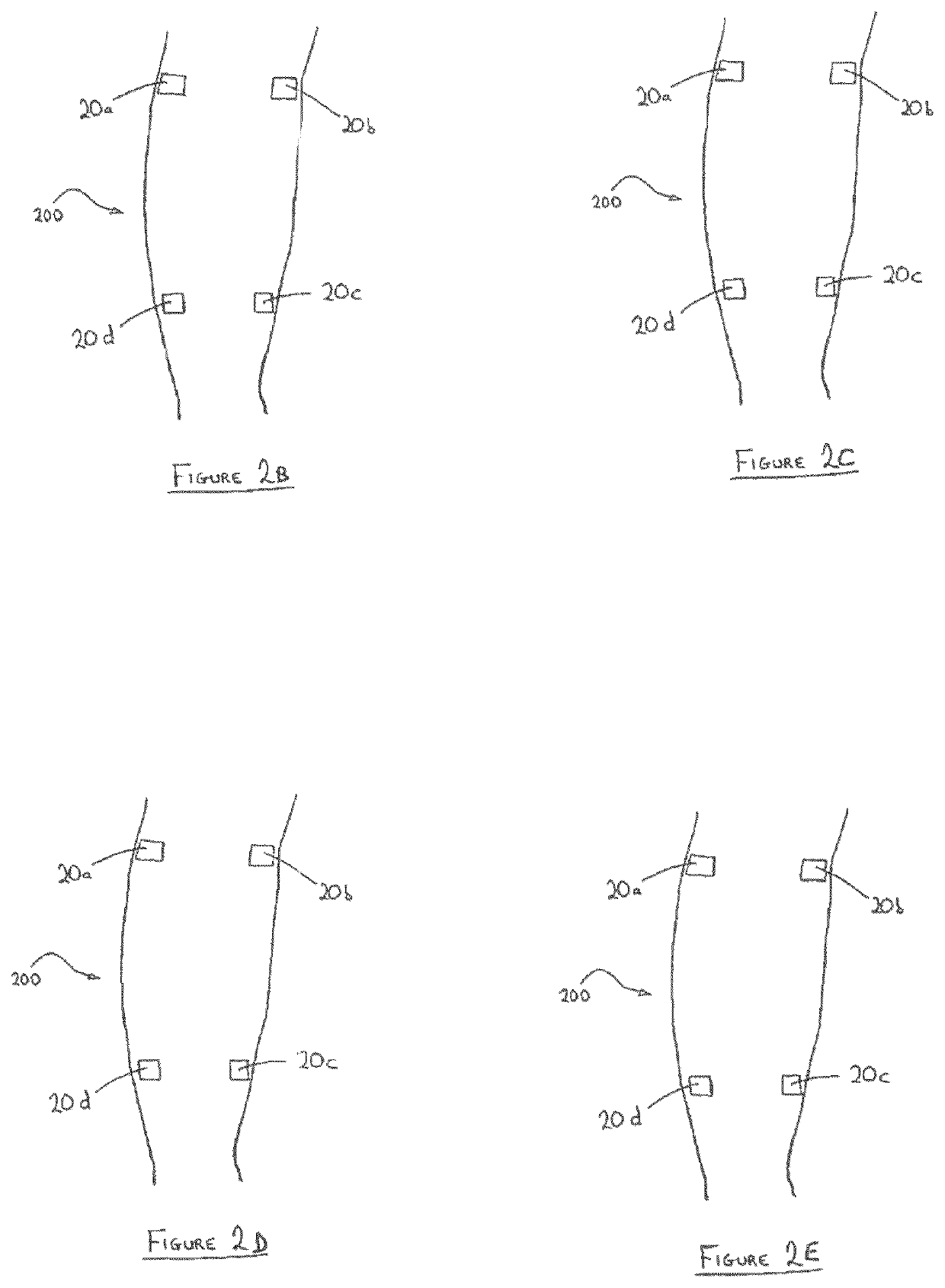 Method and device for enhanced blood flow