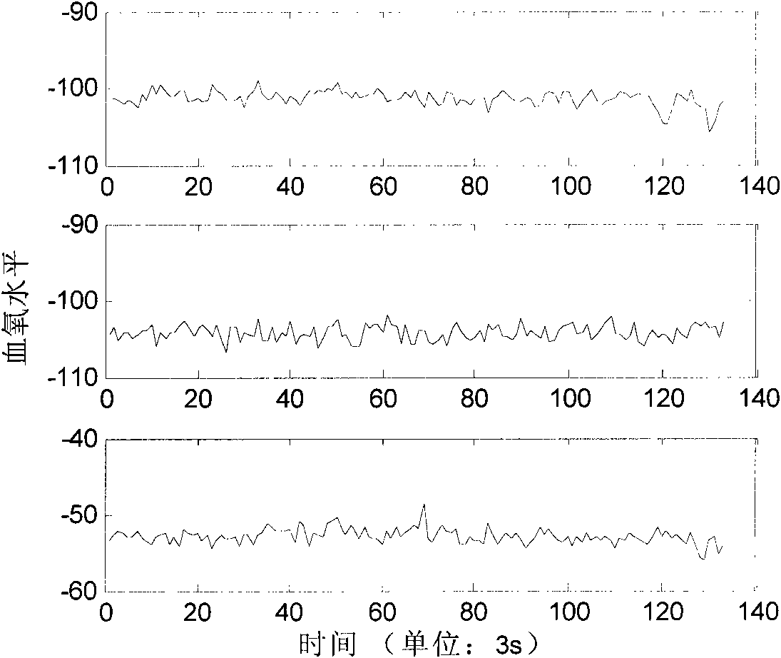 Method for recognizing function response signal under function nuclear magnetic resonance scan