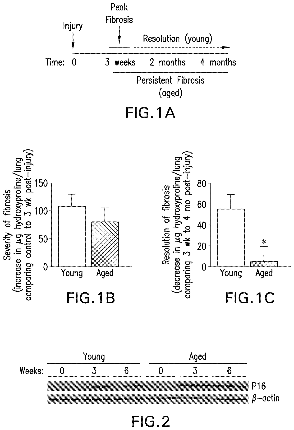 Method of treating one or more symptoms of pulmonary fibrosis by administering inhibitors of nicotinamide phosphoribotransferase