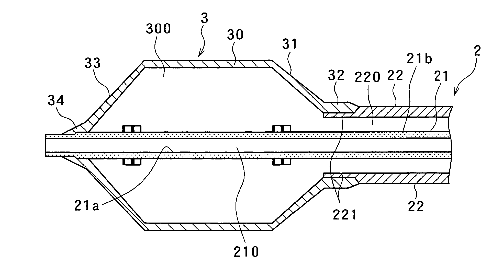 Catheter with expandable member