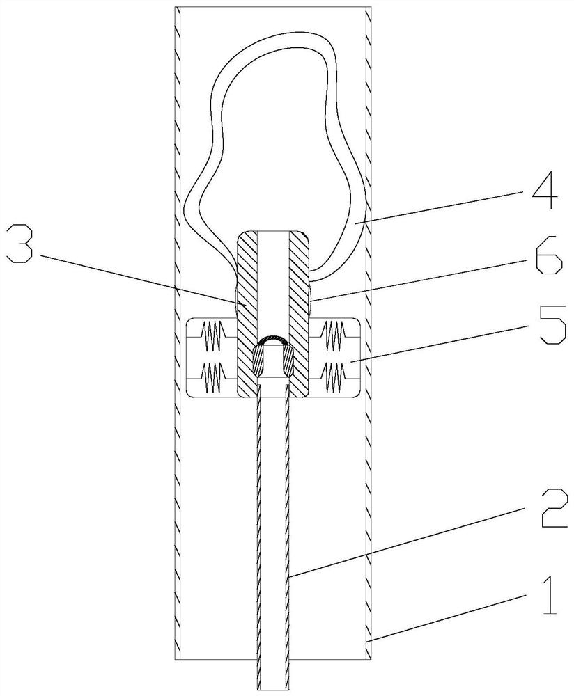 Micro-occluder for cerebral aneurysm