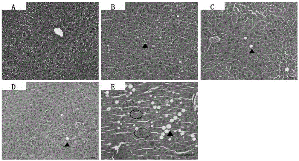 Feed for preparation of alcoholic liver animal model