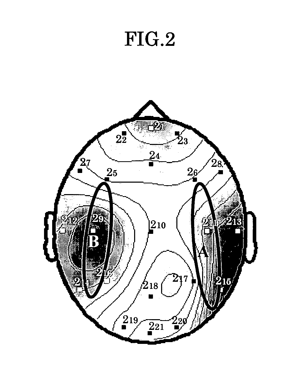 Method and apparatus for measuring degree of neuronal impairment in brain cortex