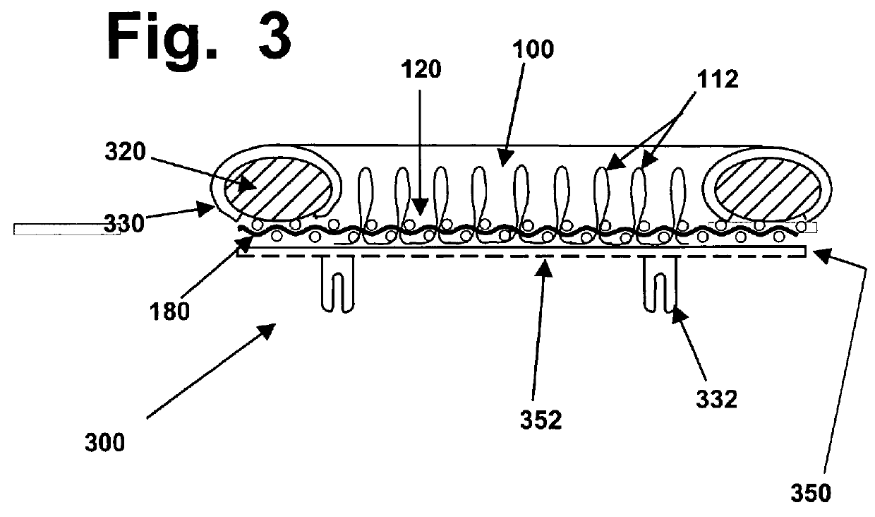 Implants for replacing hyaline cartilage, with hydrogel reinforced by three-dimensional fiber arrays