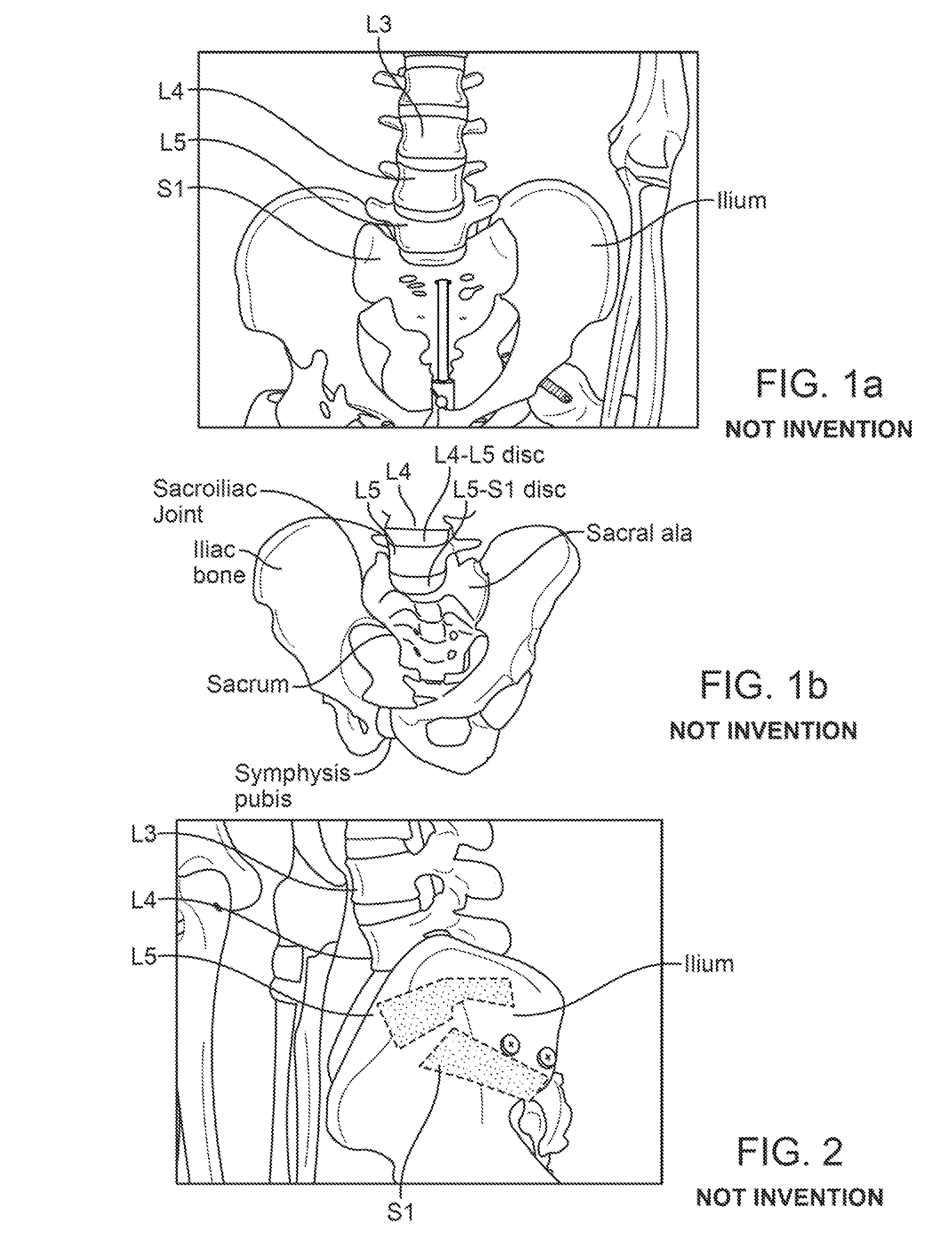 Support device and method