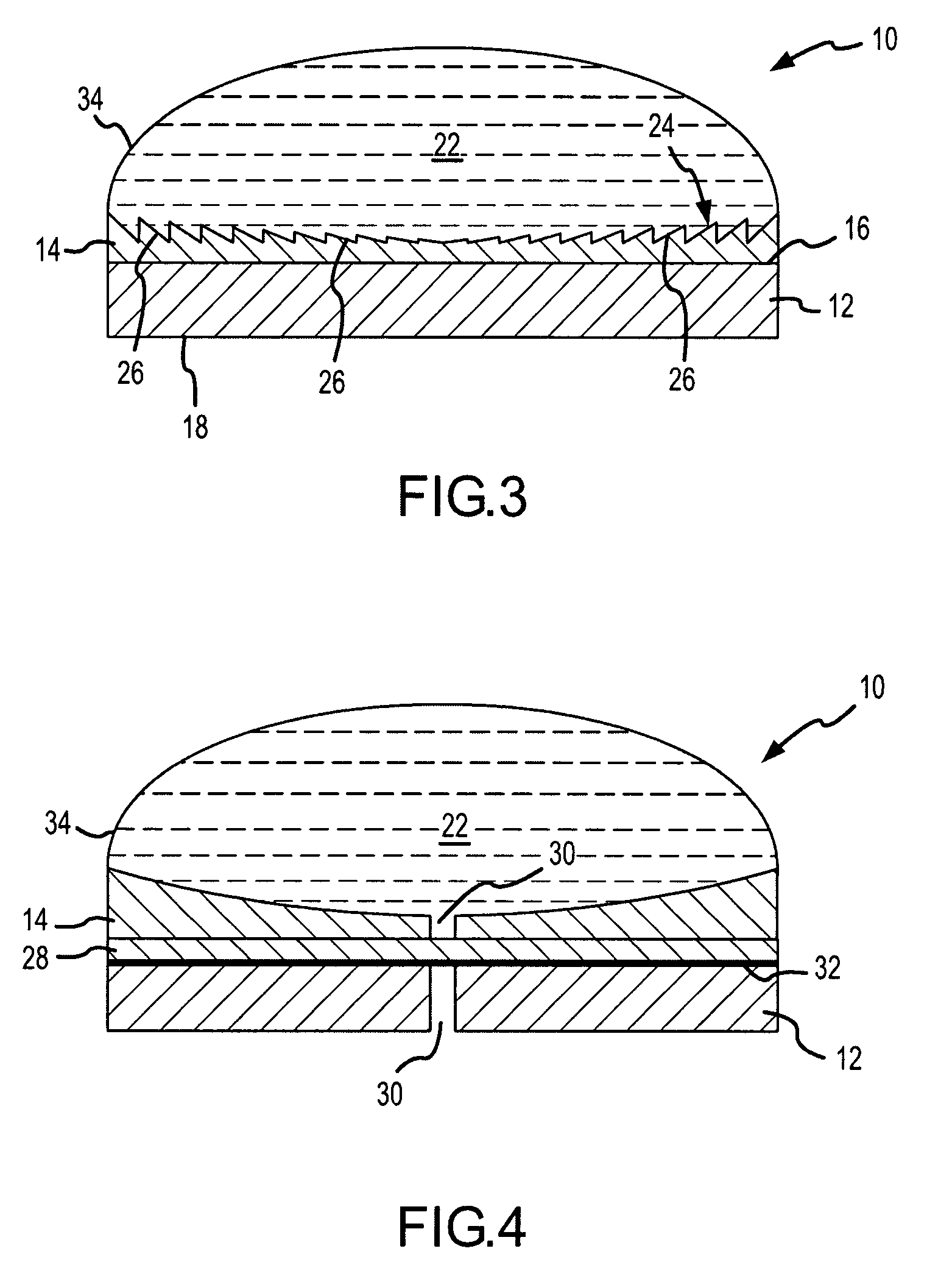 High intensity focused ultrasound transducer with acoustic lens