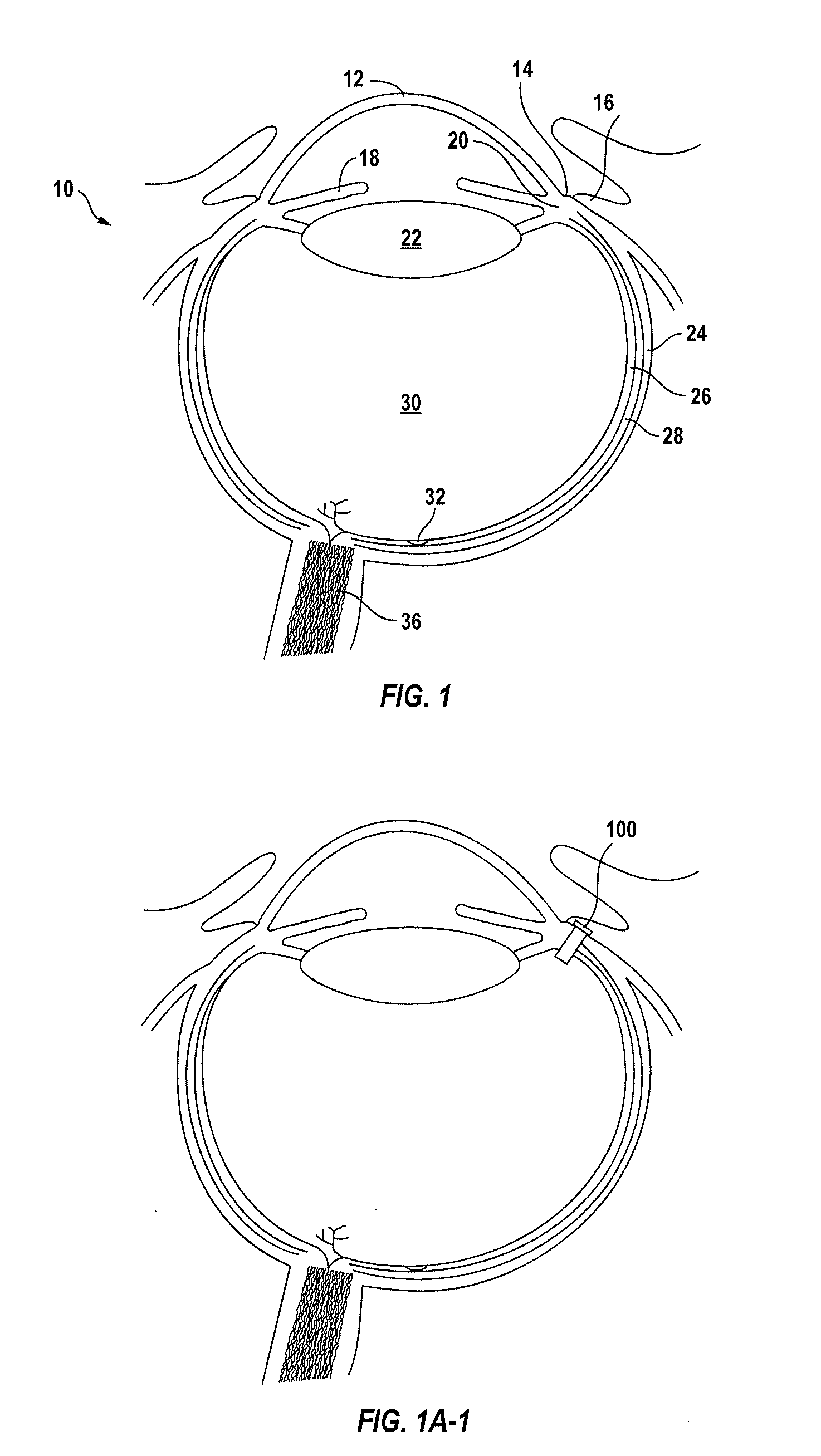 Posterior segment drug delivery