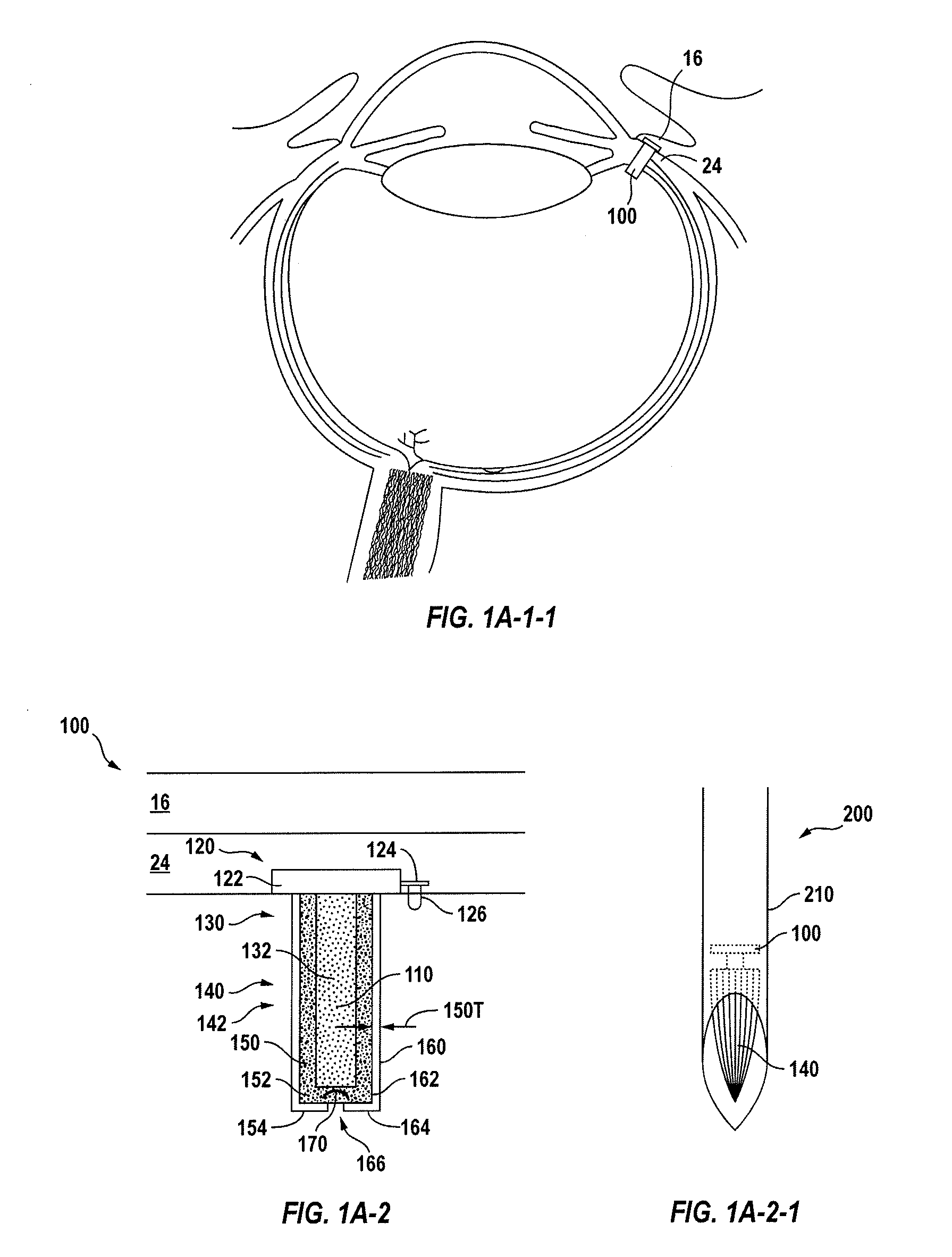 Posterior segment drug delivery