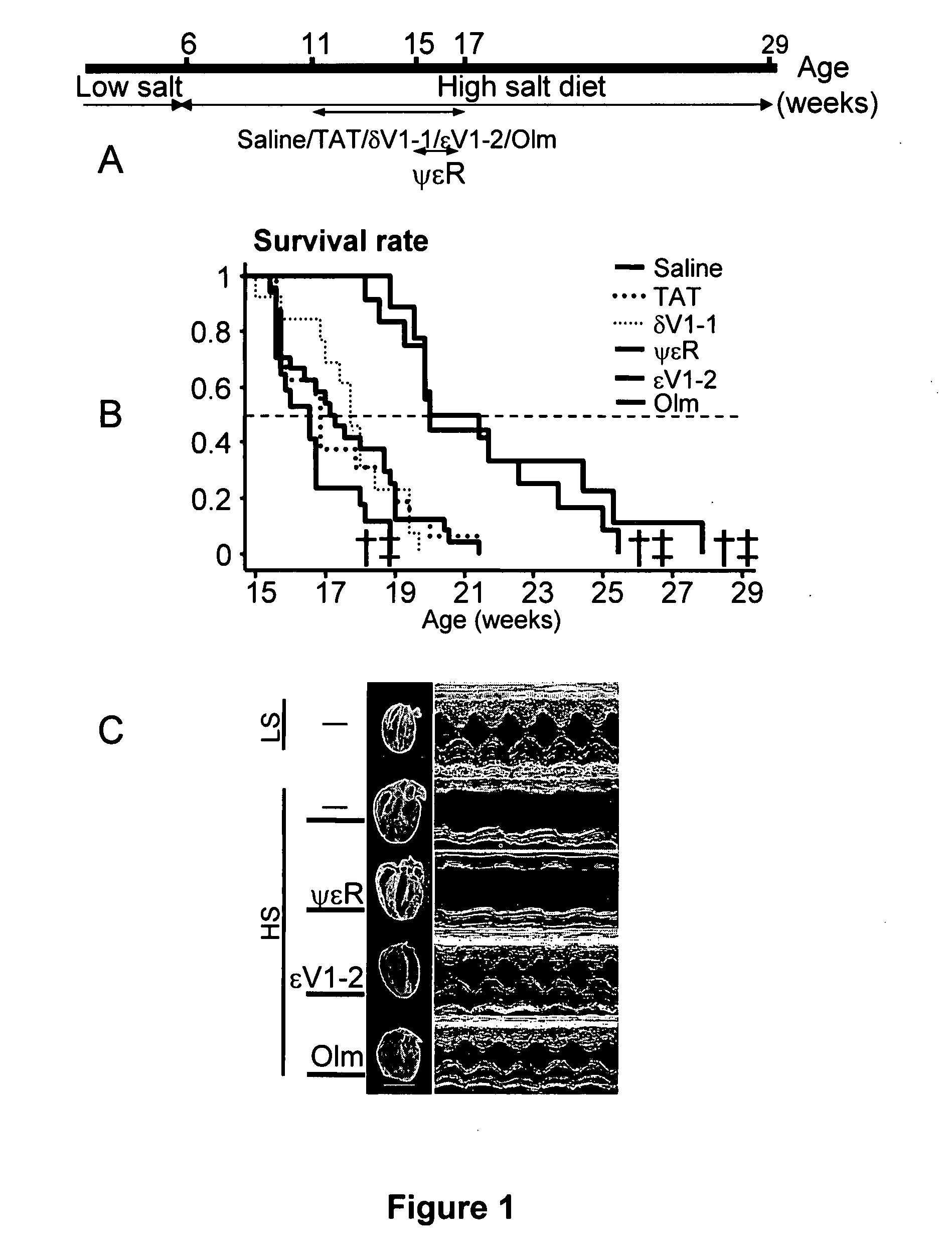 Method of preventing progression of hypertension-induced heart failure with PKC peptides