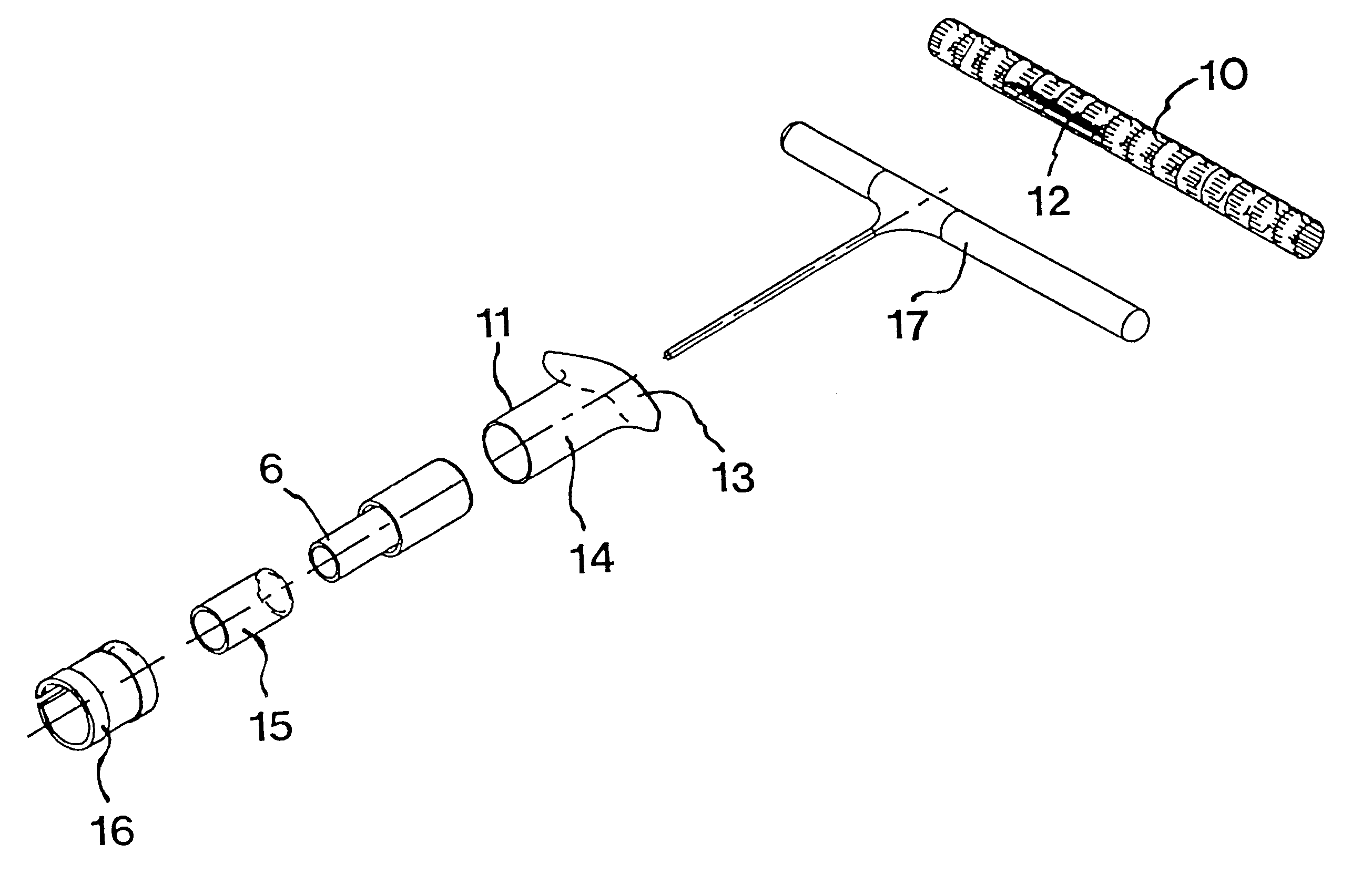 By-pass graft