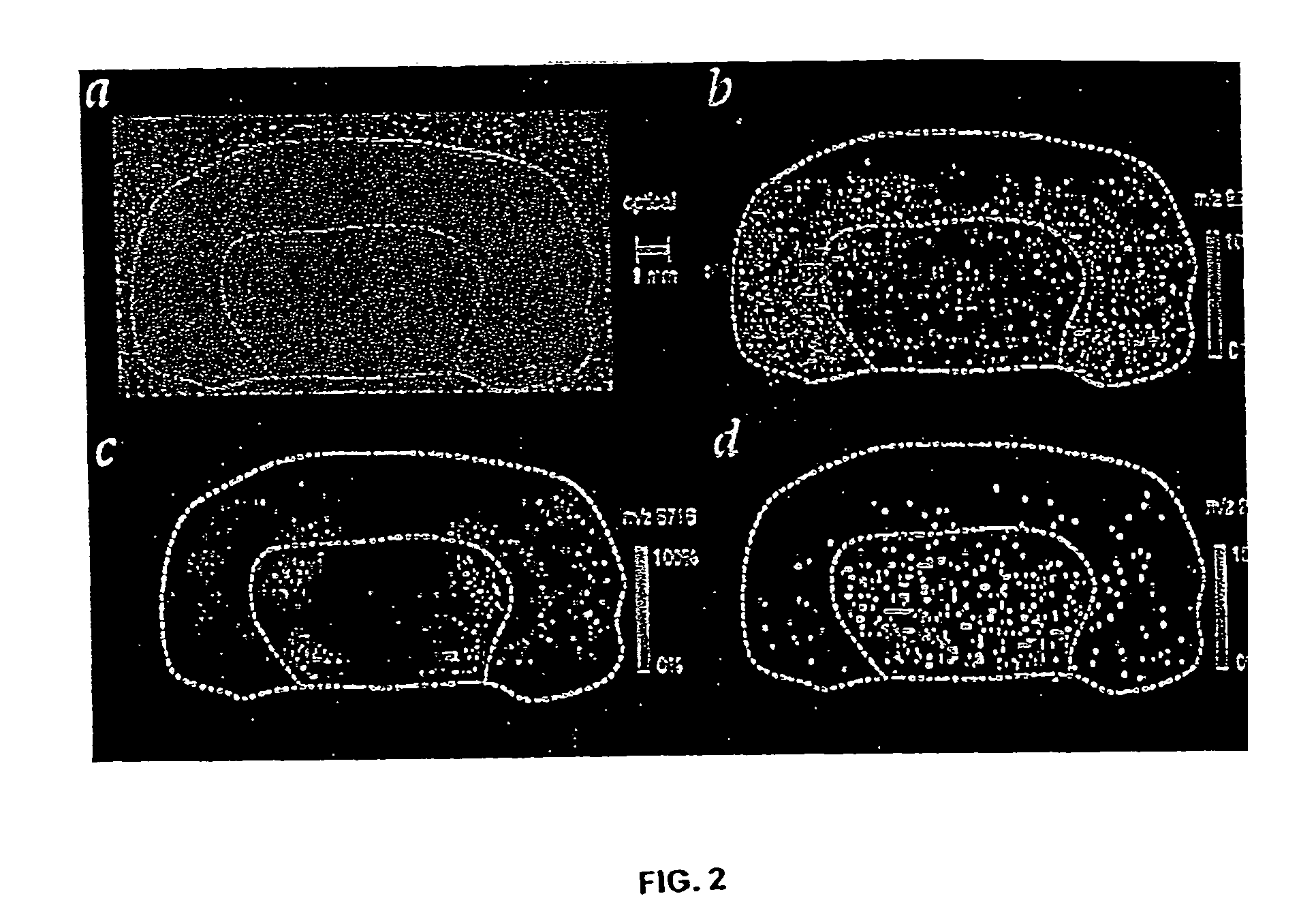 Methods and apparatuses for analyzing biological samples by mass spectrometry