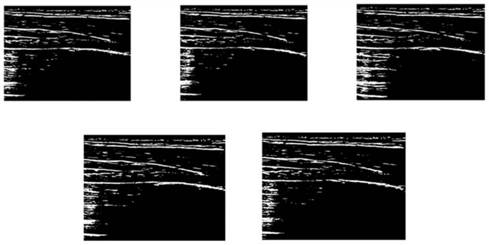 Pleura line identification method and system based on lung ultrasound