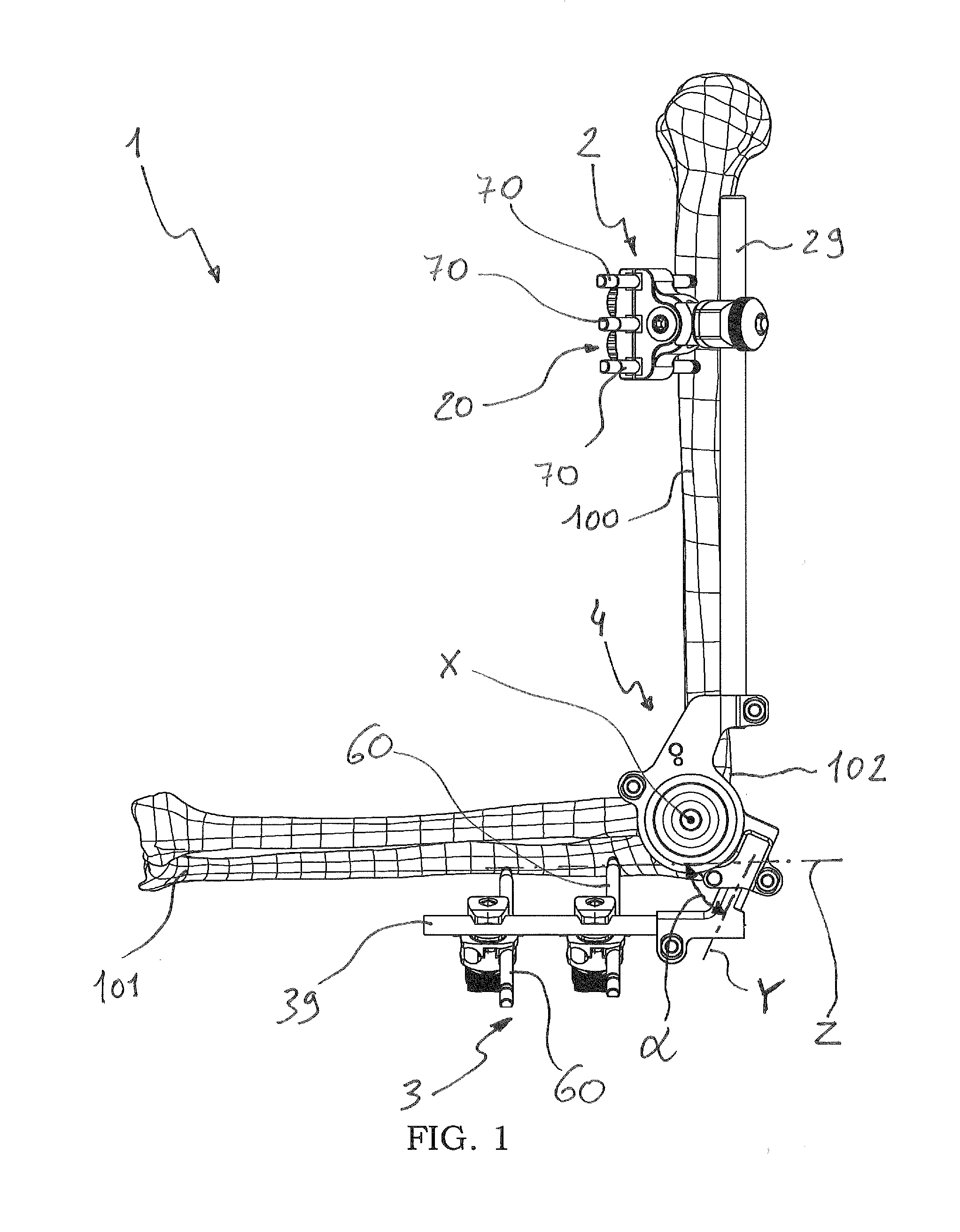 External orthopaedic fixator for the elbow joint