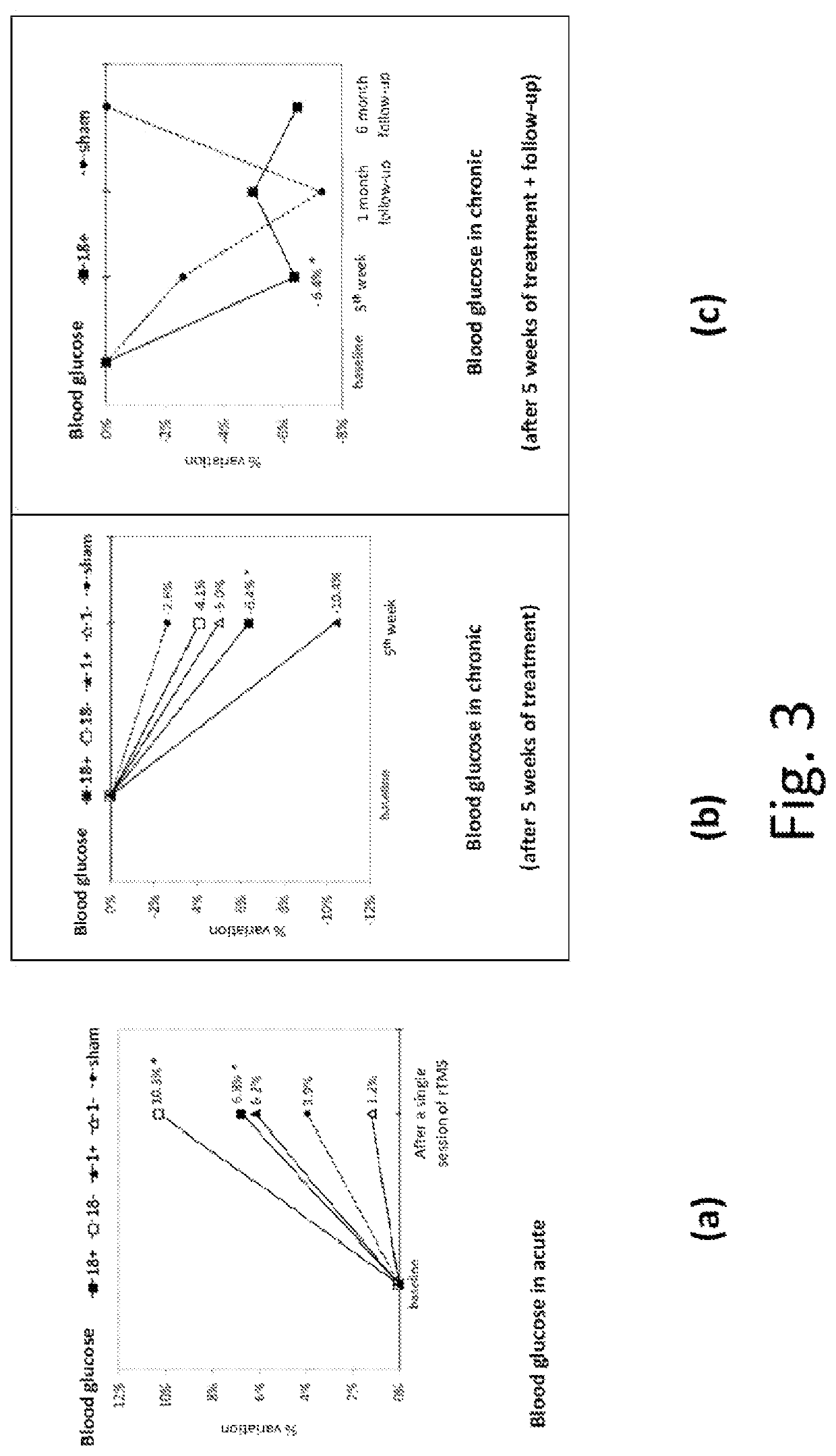 Method and system for modulating the brain electrical activity