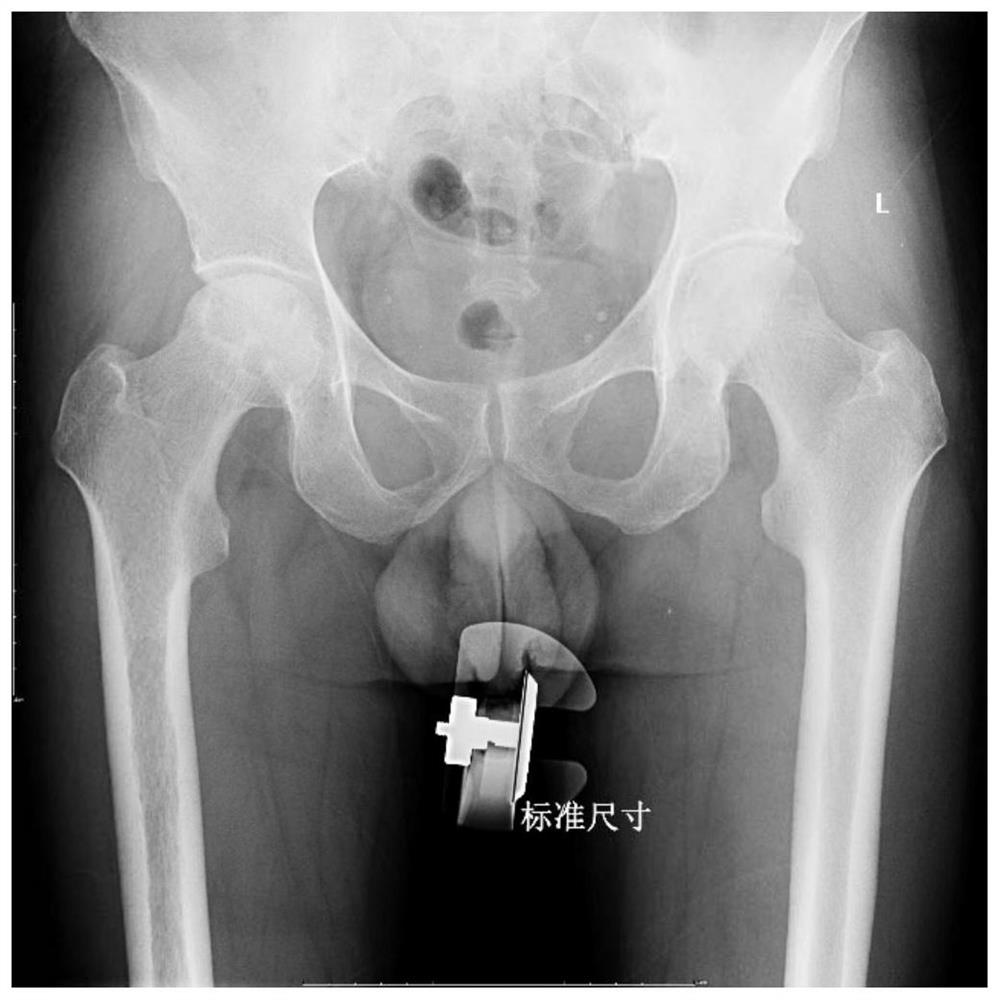 Total hip replacement preoperative planning method and device based on deep learning and X rays