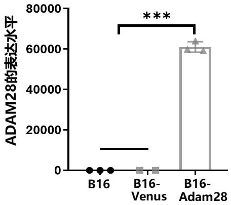 Preparation method and application of melanoma autologous tumor vaccine with high expression of adam-28