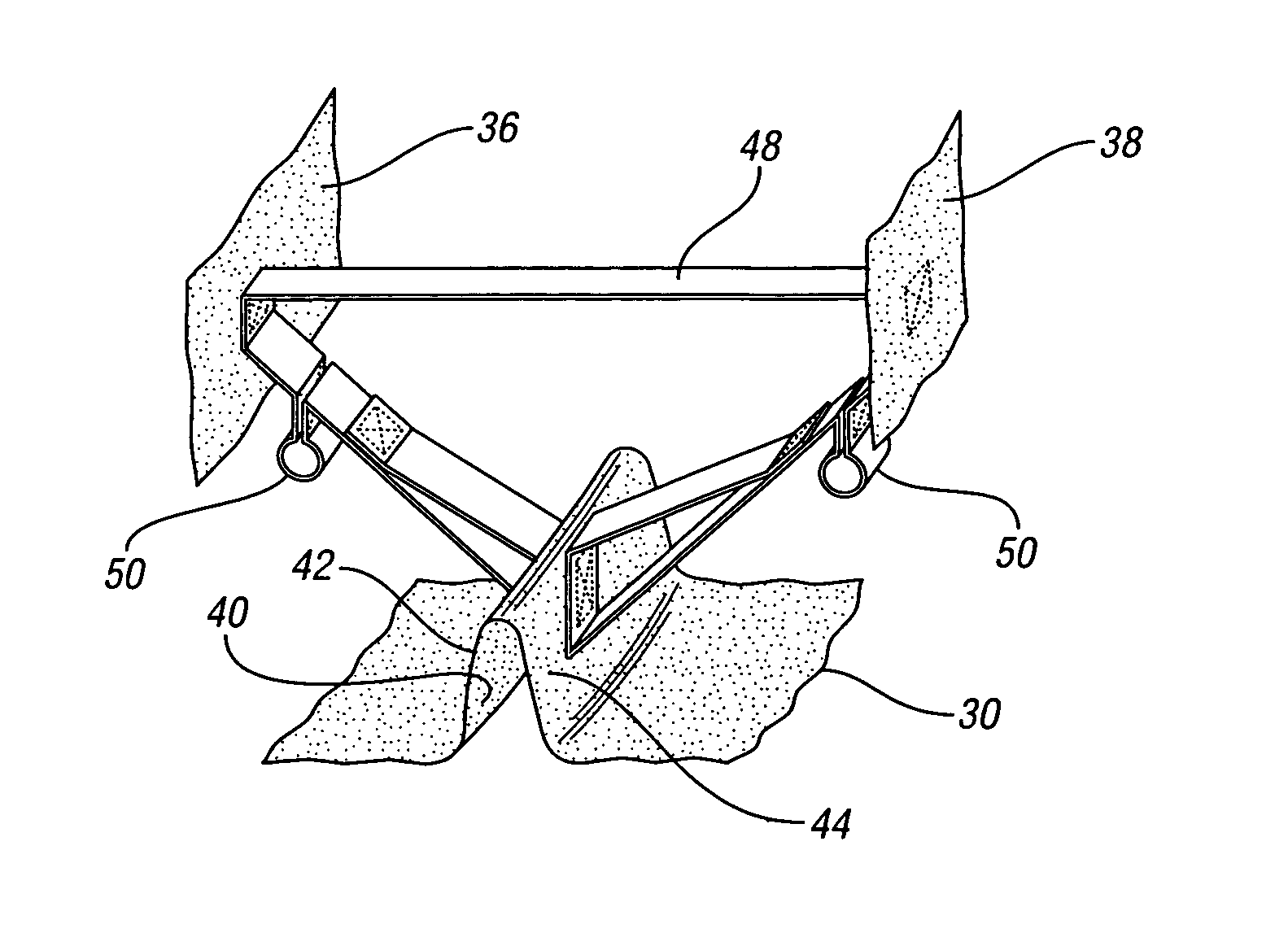 Air bag with a supported channel