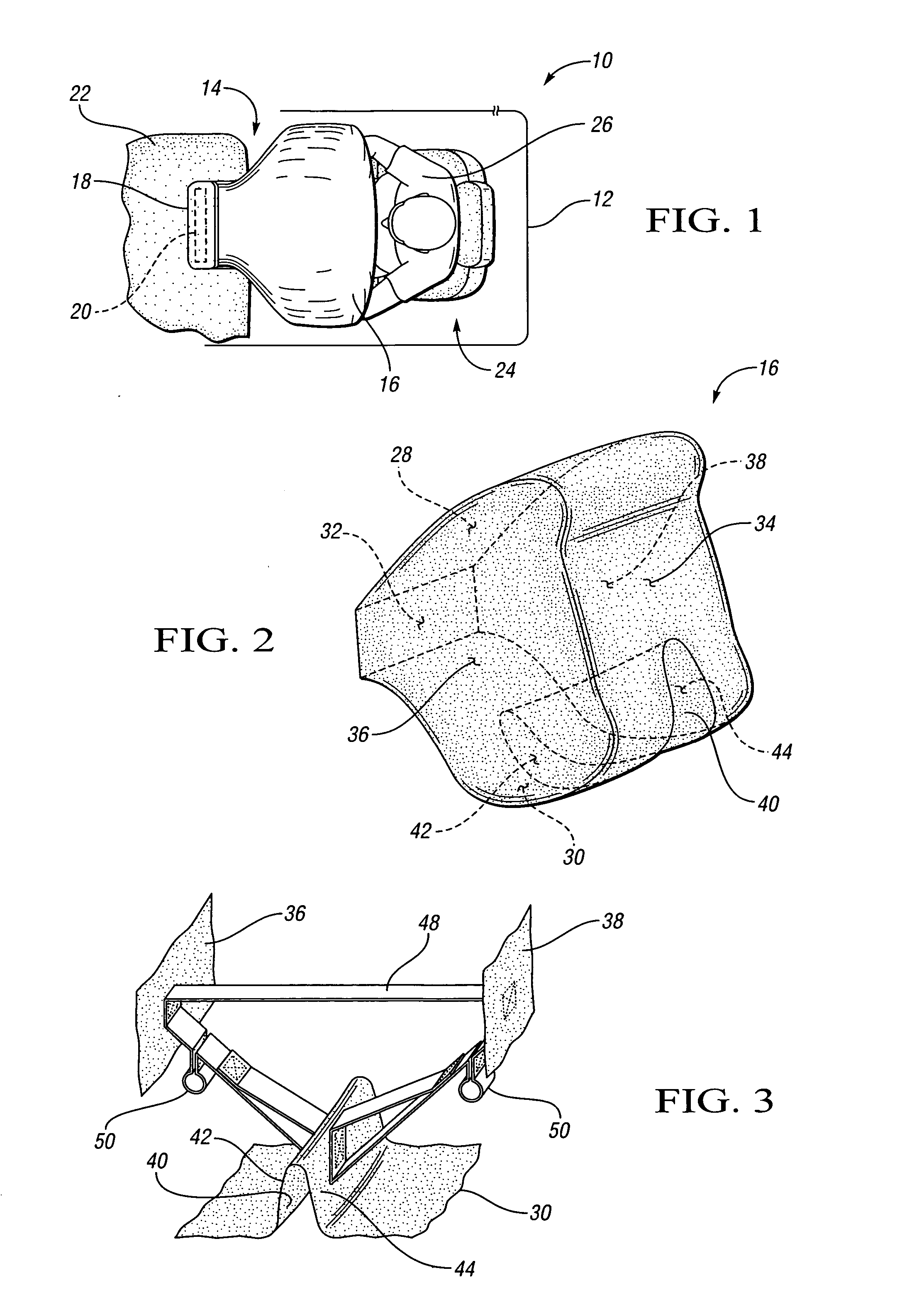 Air bag with a supported channel