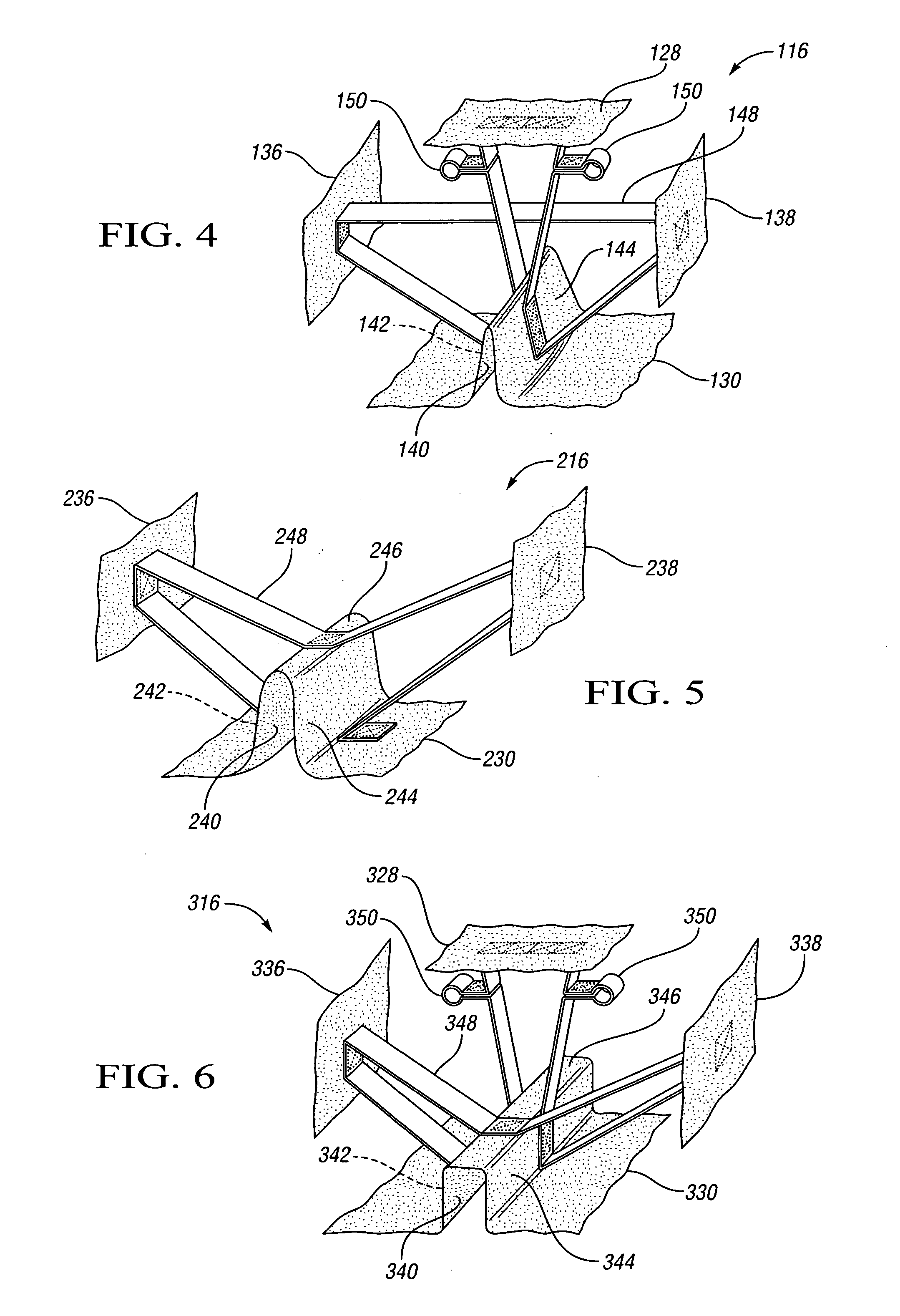 Air bag with a supported channel